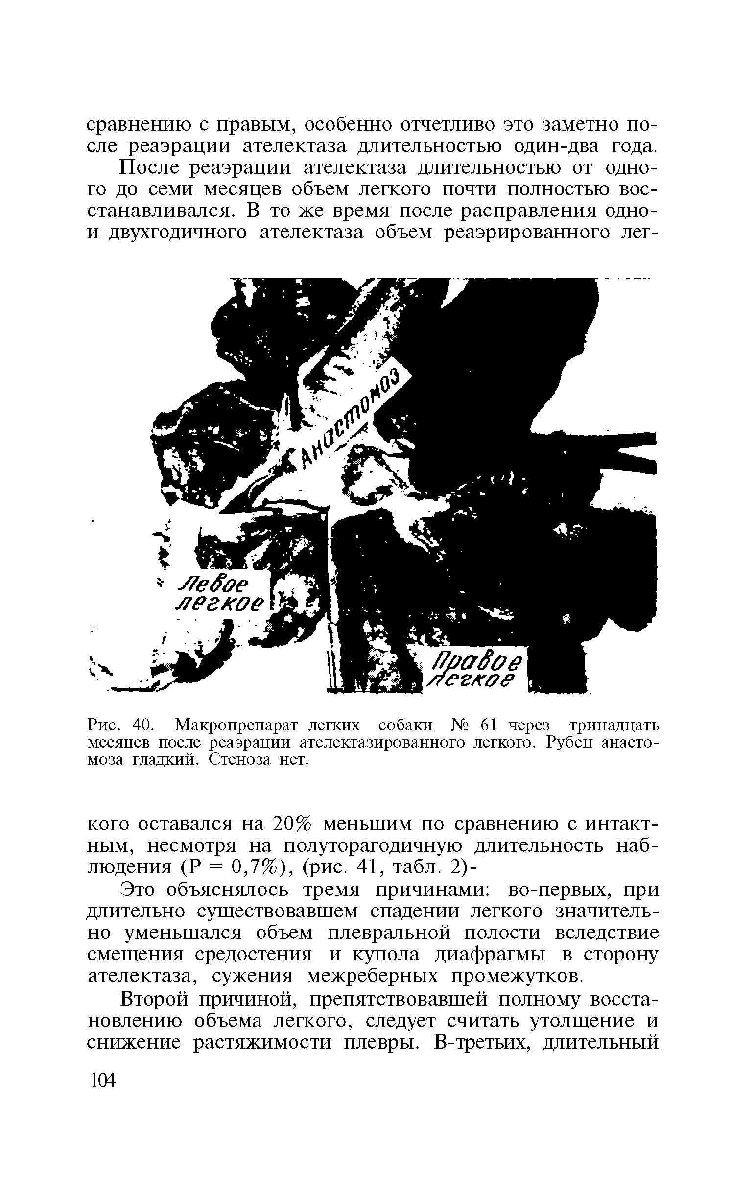 Рис. 40. Макропрепарат легких собаки № 61 через тринадцать месяцев после реаэрации ателектазированного легкого. Рубец анастомоза гладкий. Стеноза нет.