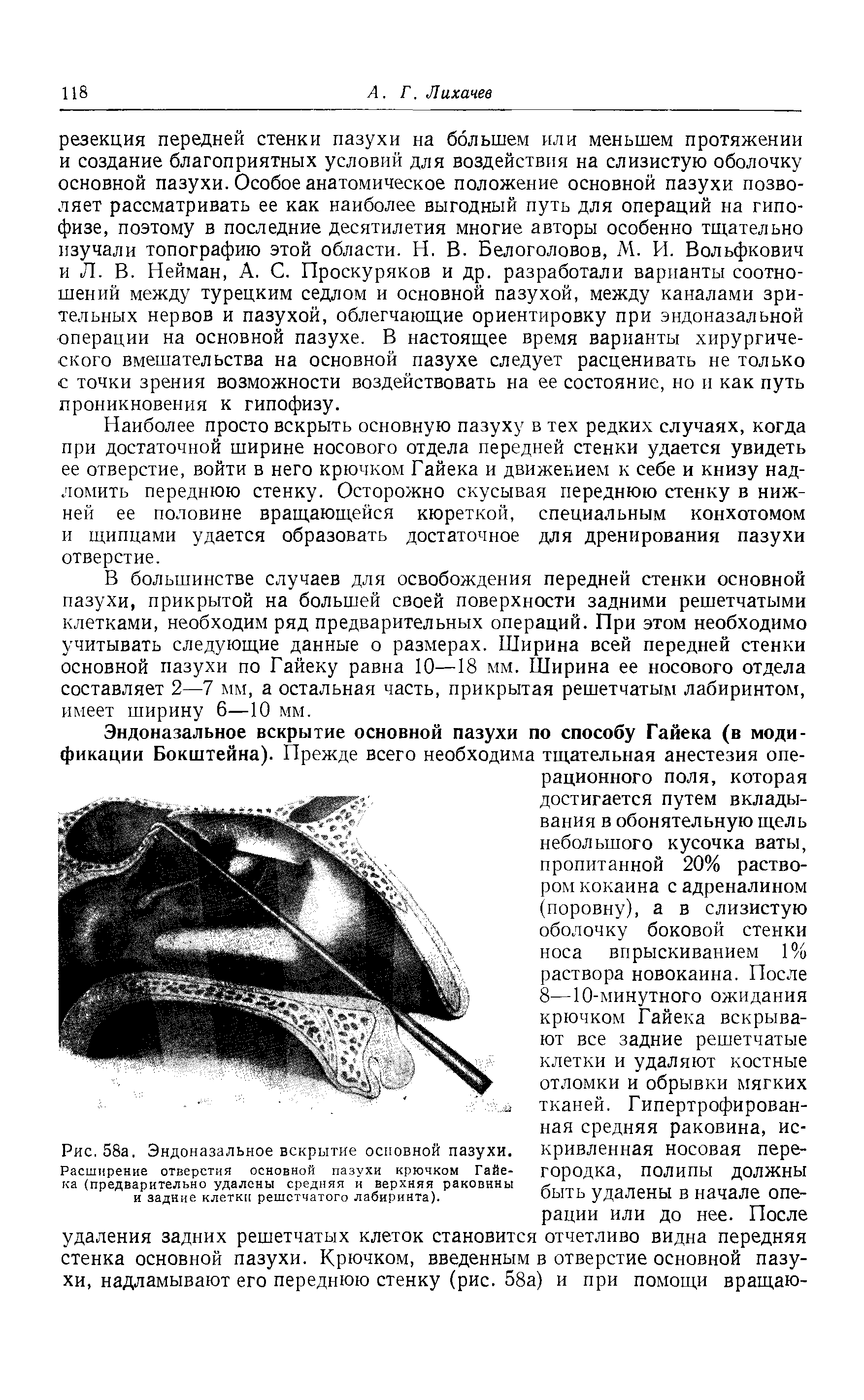 Рис. 58а. Эндоназальное вскрытие основной пазухи. Расширение отверстия основной пазухи крючком Гайека (предварительно удалены средняя и верхняя раковины и задние клетки решетчатого лабиринта).