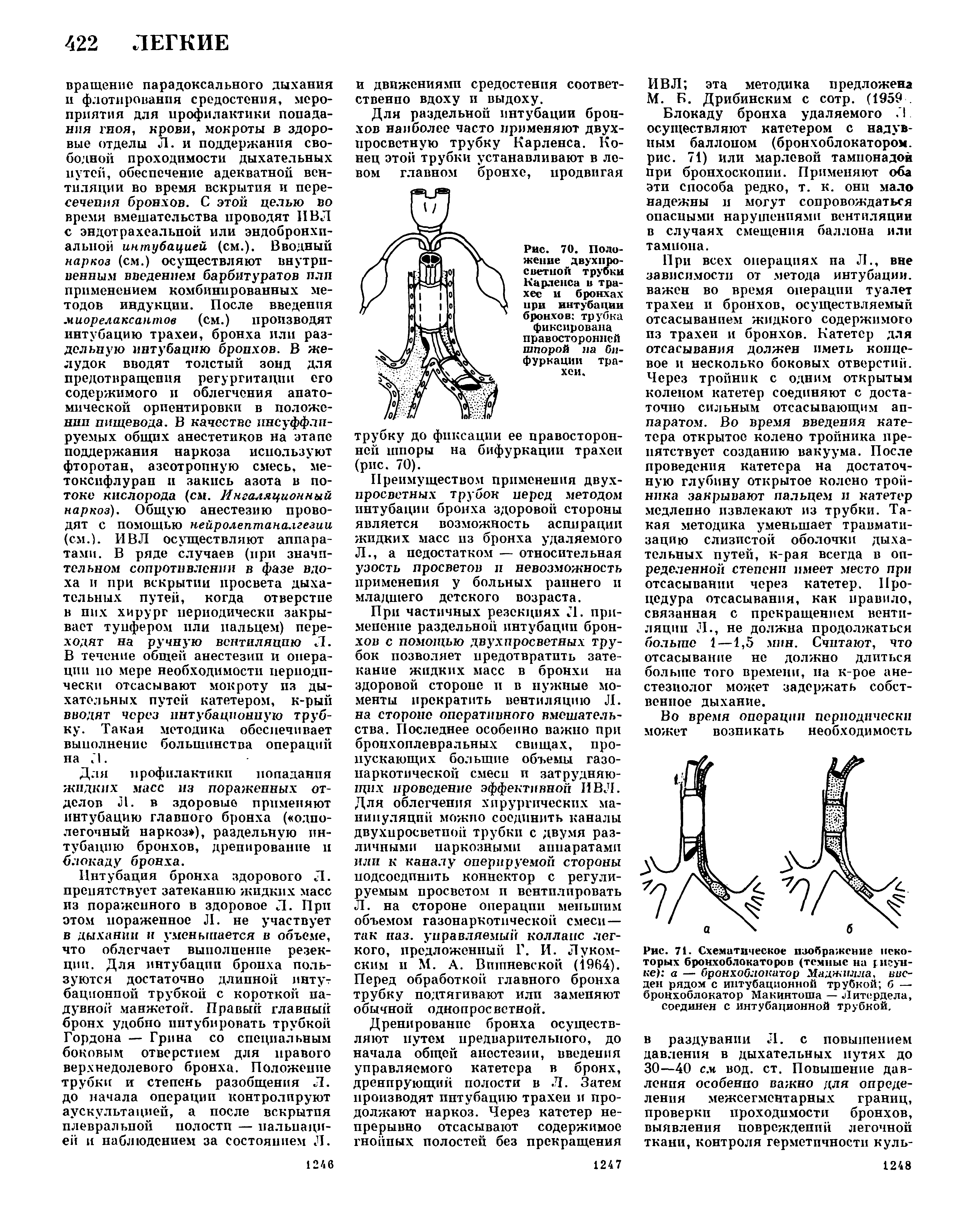 Рис. 70. Положение двухпросветной трубки Карленса в трахее и бронхах при интубации бронхов трубка фиксирована правосторонней шпорой ла бифуркации трахеи.