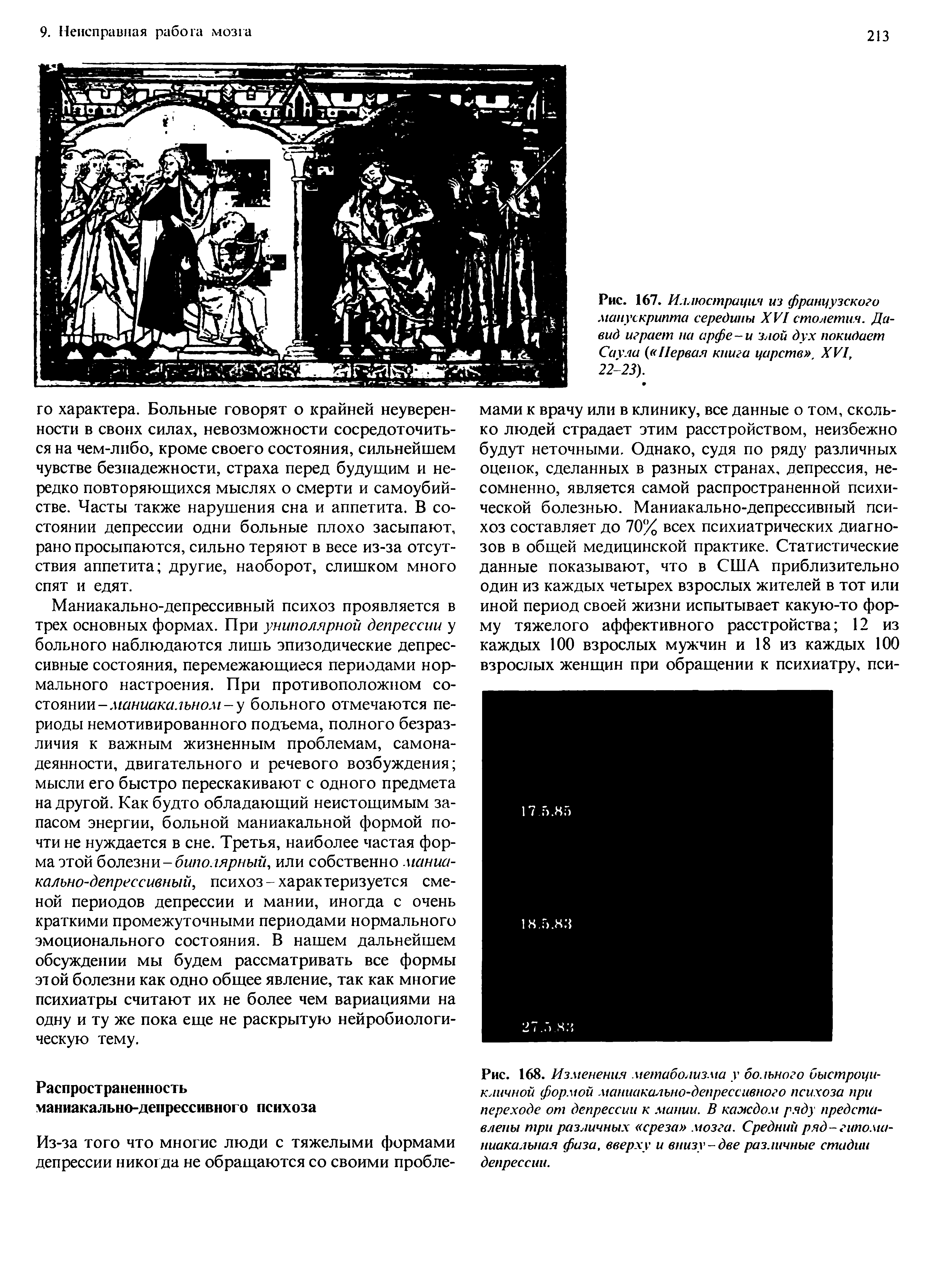 Рис. 168. Изменения метаболизма г больного быстроцикличной формой маниакально-депрессивного психоза при переходе от депрессии к мании. В каждом ряду представлены три различных среза мозга. Средний ряд-гипома-ниакальная физа, вверху и внизу-две различные стидии депрессии.