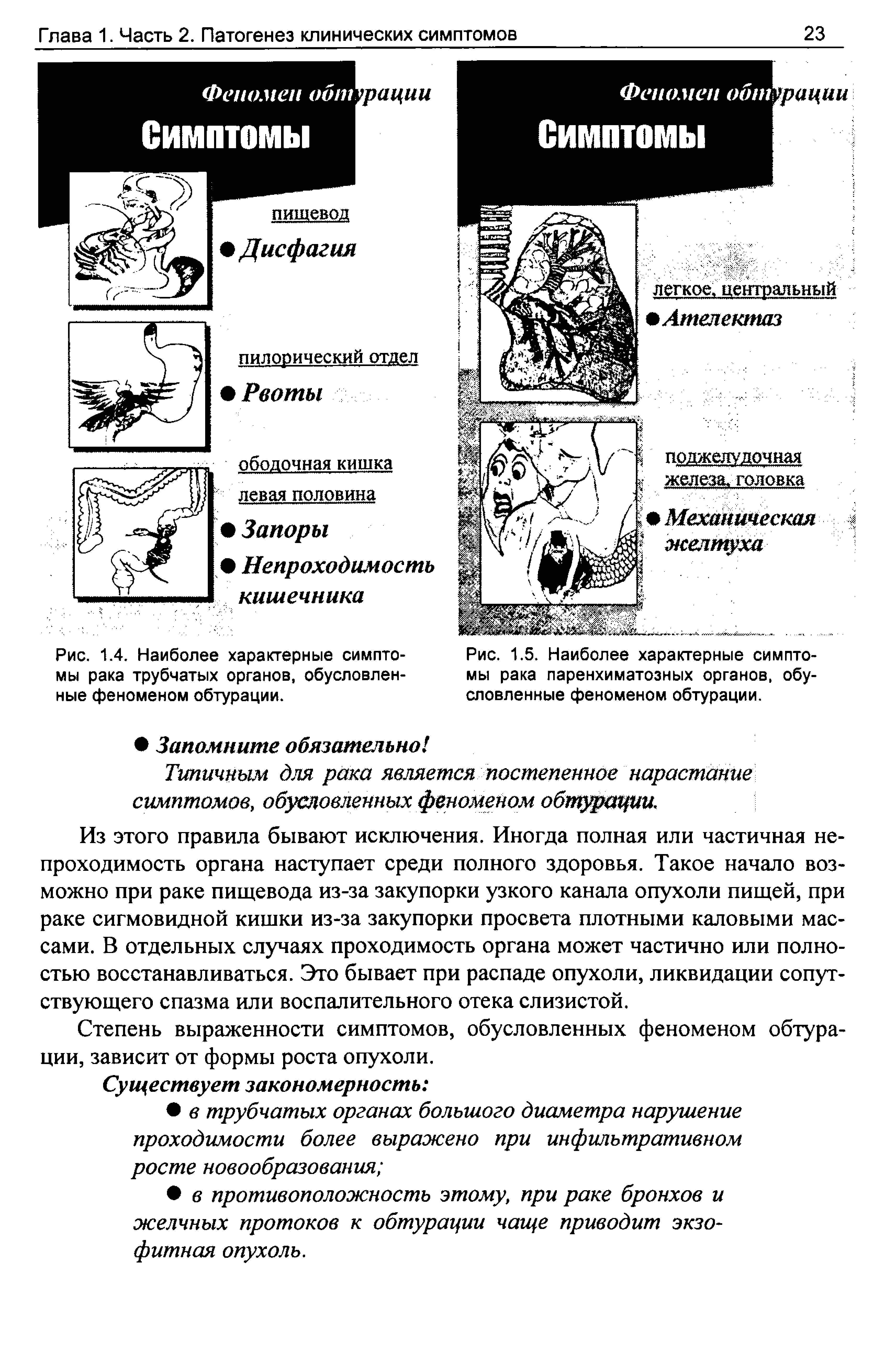 Рис. 1.4. Наиболее характерные симптомы рака трубчатых органов, обусловленные феноменом обтурации.