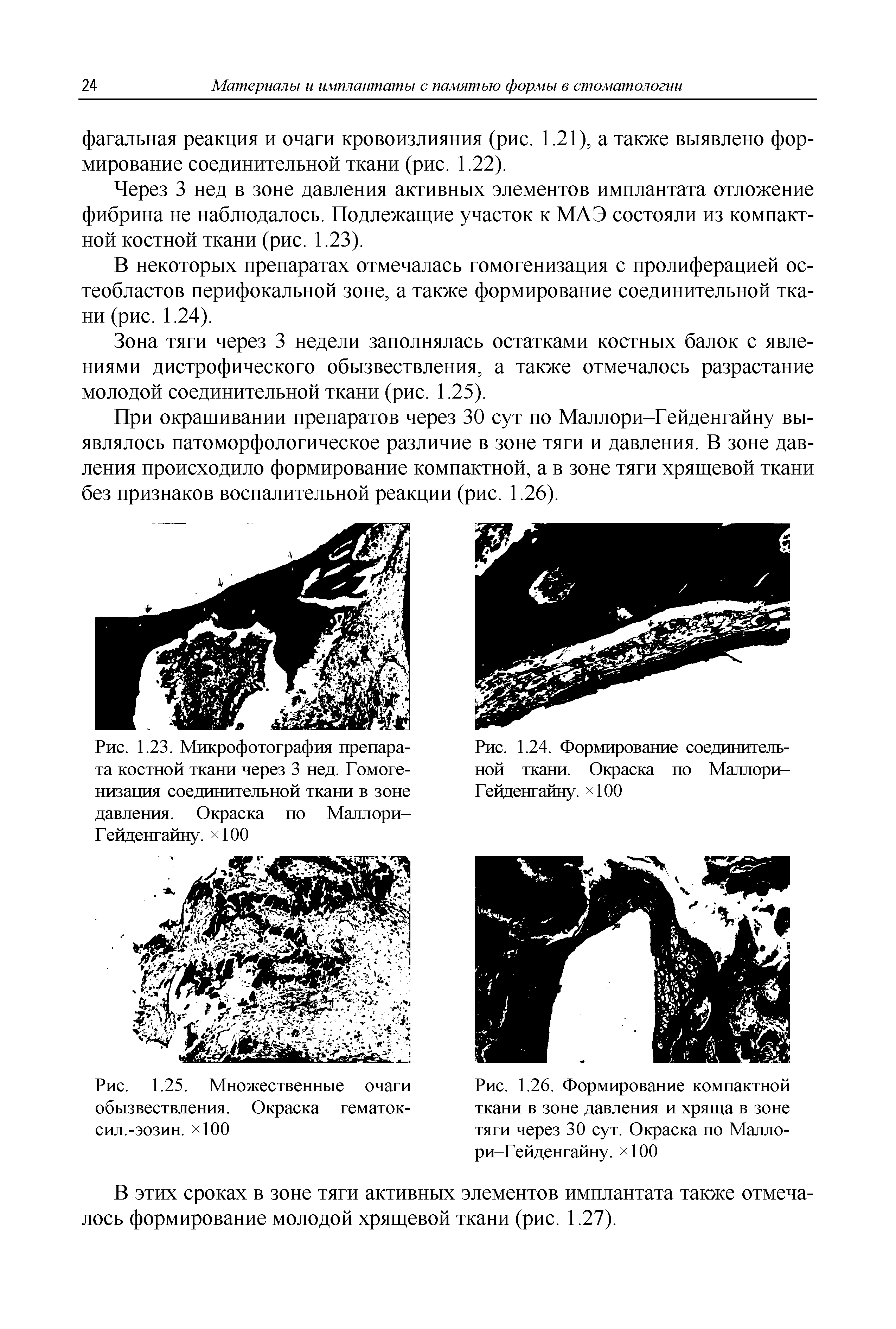 Рис. 1.23. Микрофотография препарата костной ткани через 3 нед. Гомогенизация соединительной ткани в зоне давления. Окраска по Маллори-Гейденгайну. 100...