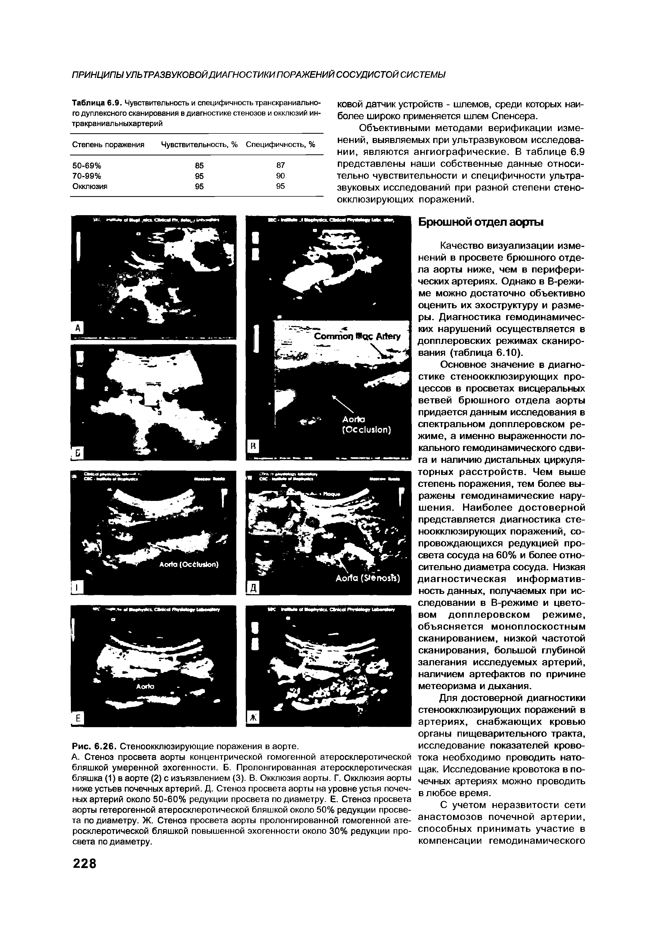Таблица 6.9. Чувствительность и специфичность транскраниального дуплексного сканирования в диагностике стенозов и окклюзий ин-тракраниальныхартерий...