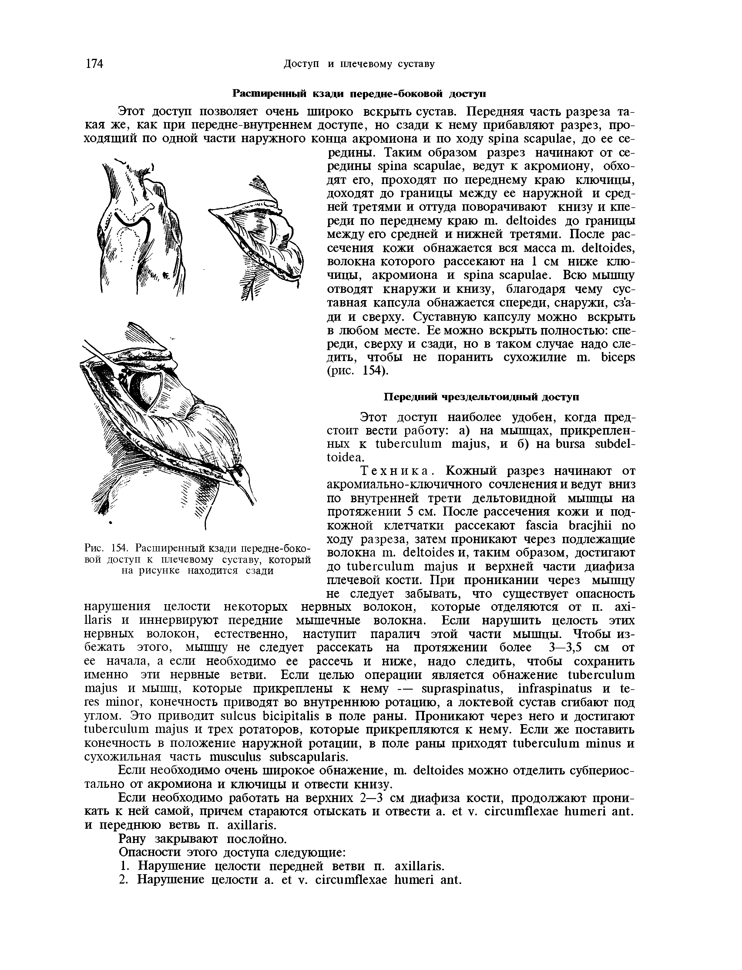 Рис. 154. Расширенный кзади передне-боковой доступ к плечевому суставу, который на рисунке находится сзади...