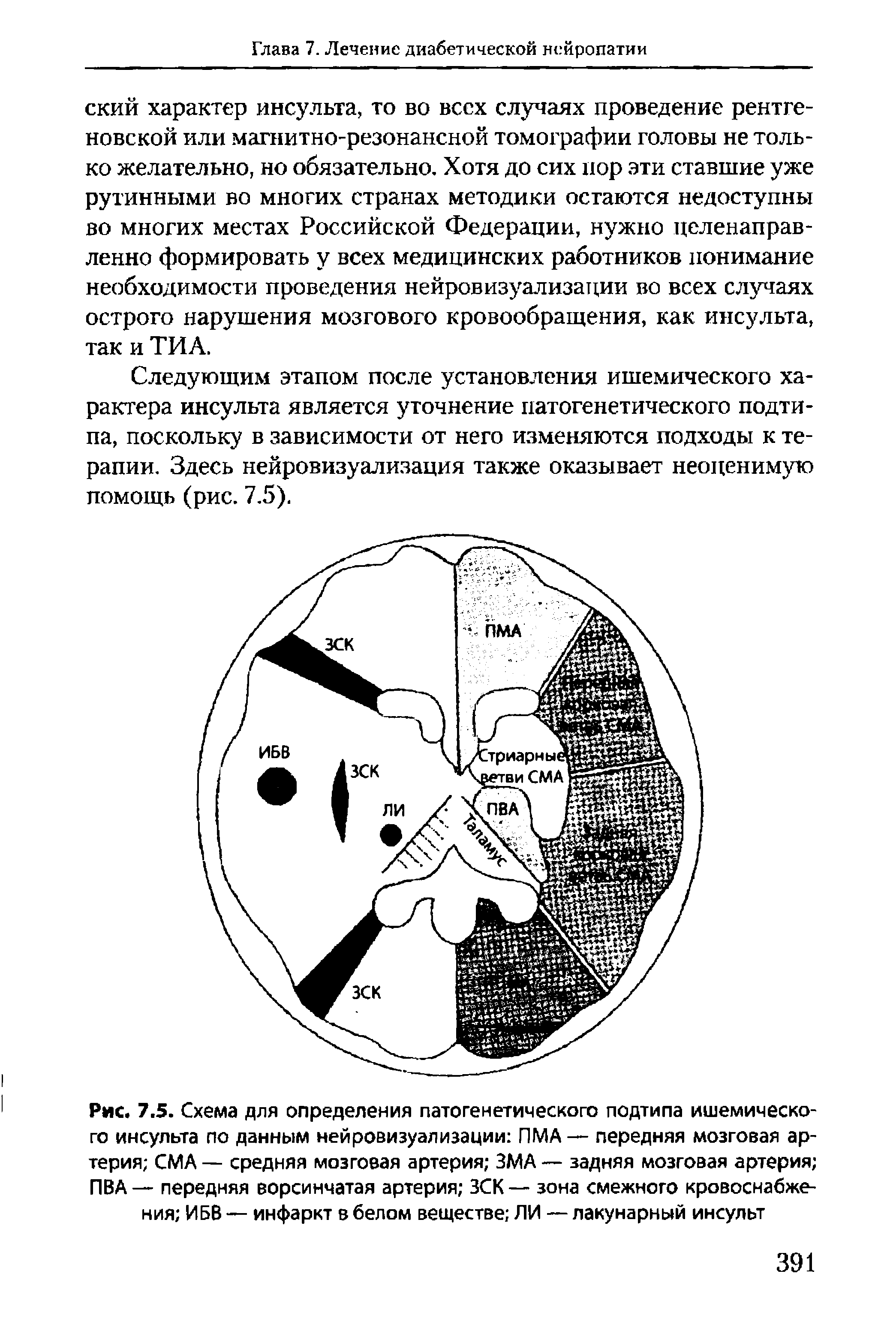 Рис. 7.5. Схема для определения патогенетического подтипа ишемического инсульта по данным нейровизуализации ПМА — передняя мозговая артерия СМ А — средняя мозговая артерия ЗМА — задняя мозговая артерия ПВА — передняя ворсинчатая артерия ЗСК — зона смежного кровоснабжения ИБВ — инфаркт в белом веществе ЛИ — лакунарный инсульт...