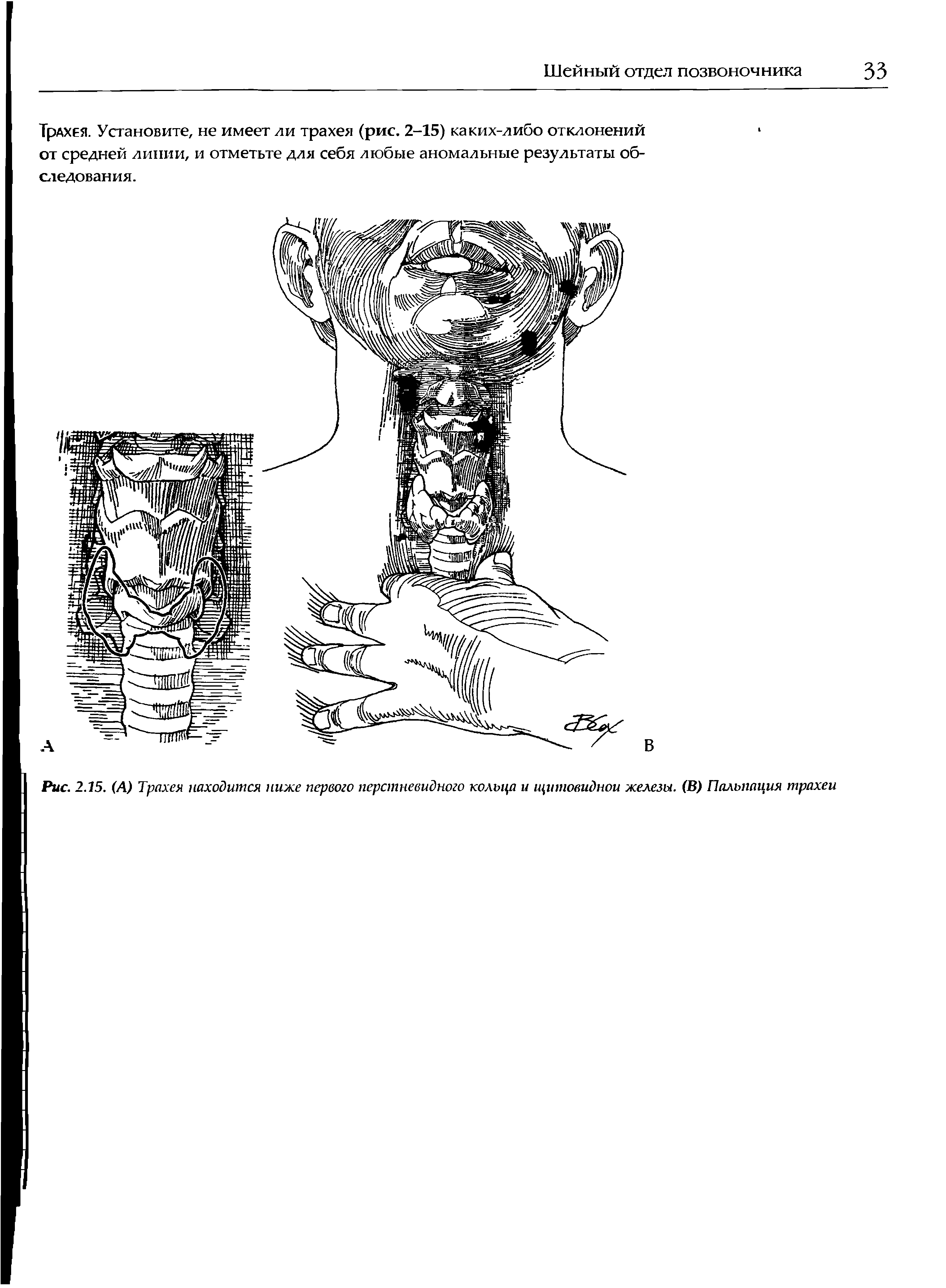 Рис. 2.15. (А) Трахея находится ниже первого перстневидного кольца и щитовидной железы. (В) Пальпация трахеи...