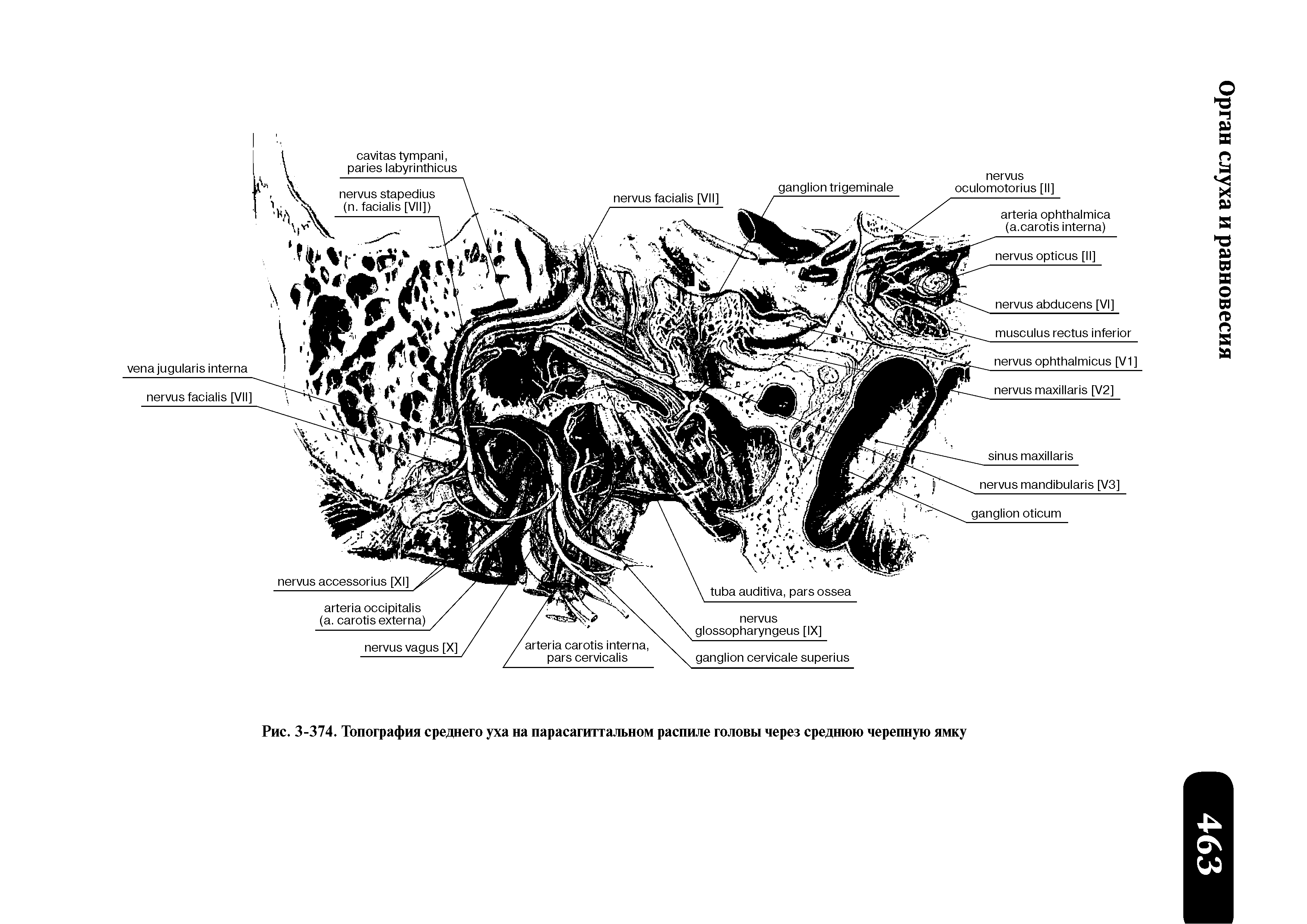 Рис. 3-374. Топография среднего уха на парасагиттальном распиле головы через среднюю черепную ямку...