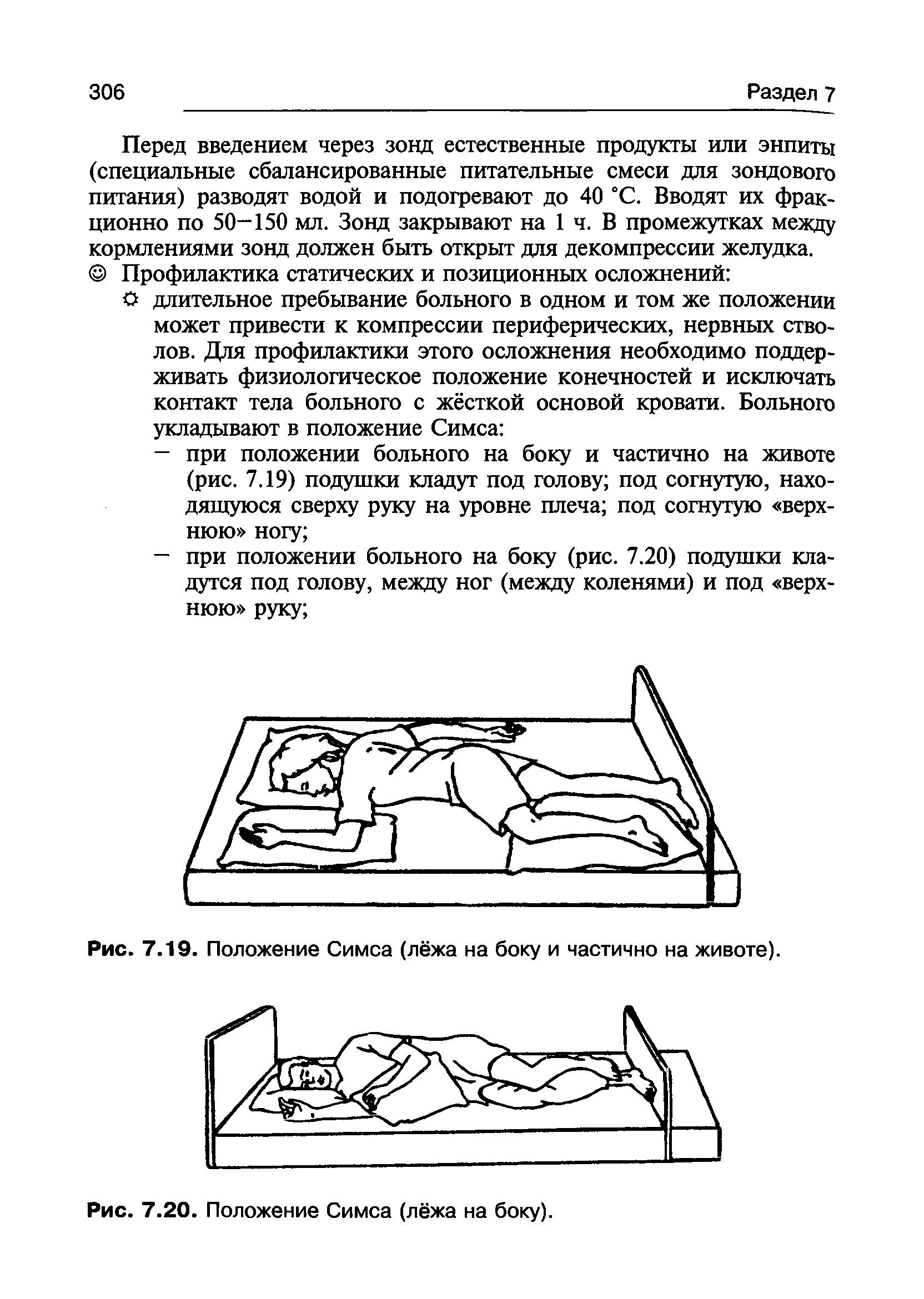 Рис. 7.19. Положение Симса (лёжа на боку и частично на животе).