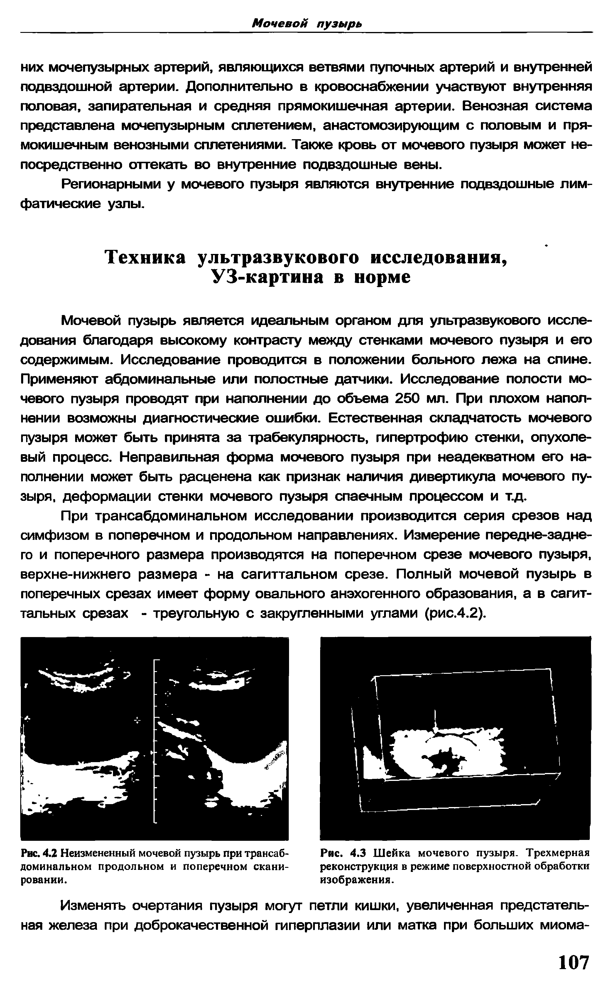 Рис. 4.2 Неизмененный мочевой пузырь при трансабдоминальном продольном и поперечном сканировании.