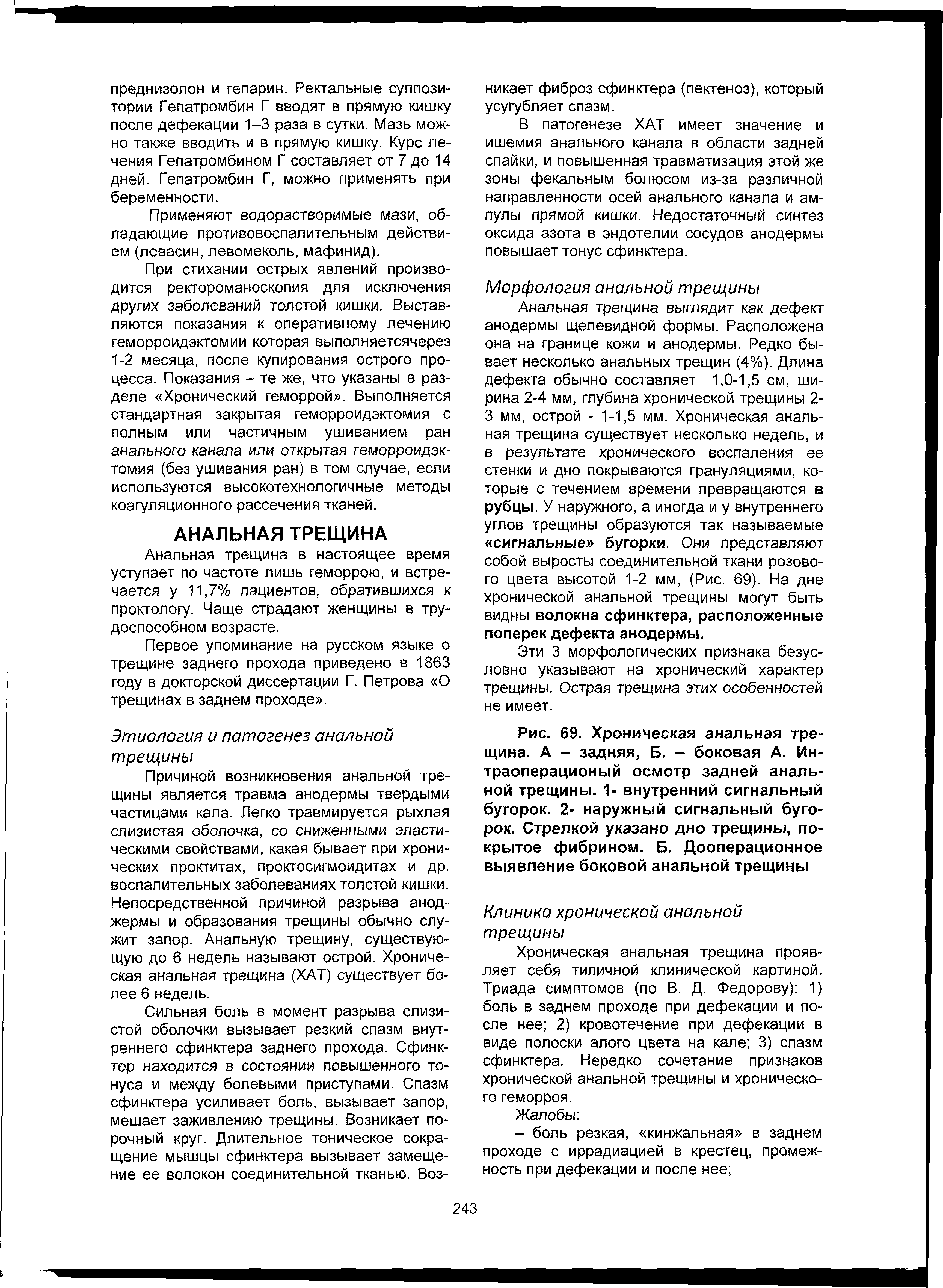 Рис. 69. Хроническая анальная трещина. А - задняя, Б. - боковая А. Ин-траоперационый осмотр задней анальной трещины. 1- внутренний сигнальный бугорок. 2- наружный сигнальный бугорок. Стрелкой указано дно трещины, покрытое фибрином. Б. Дооперационное выявление боковой анальной трещины...