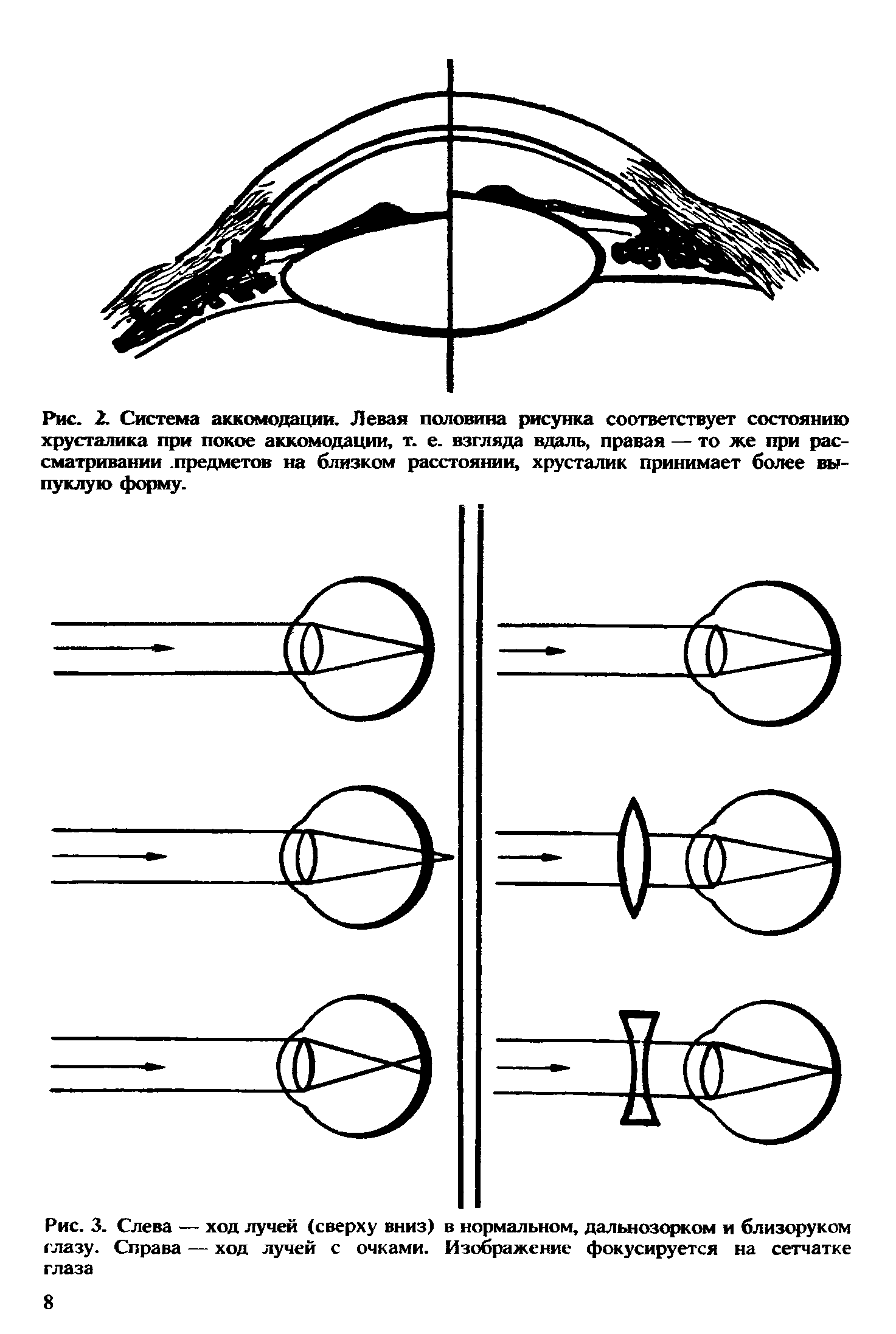 Рис. 3. Слева — ход лучей (сверху вниз) в нормальном, дальнозорком и близоруком глазу. Справа — ход лучей с очками. Изображение фокусируется на сетчатке глаза...
