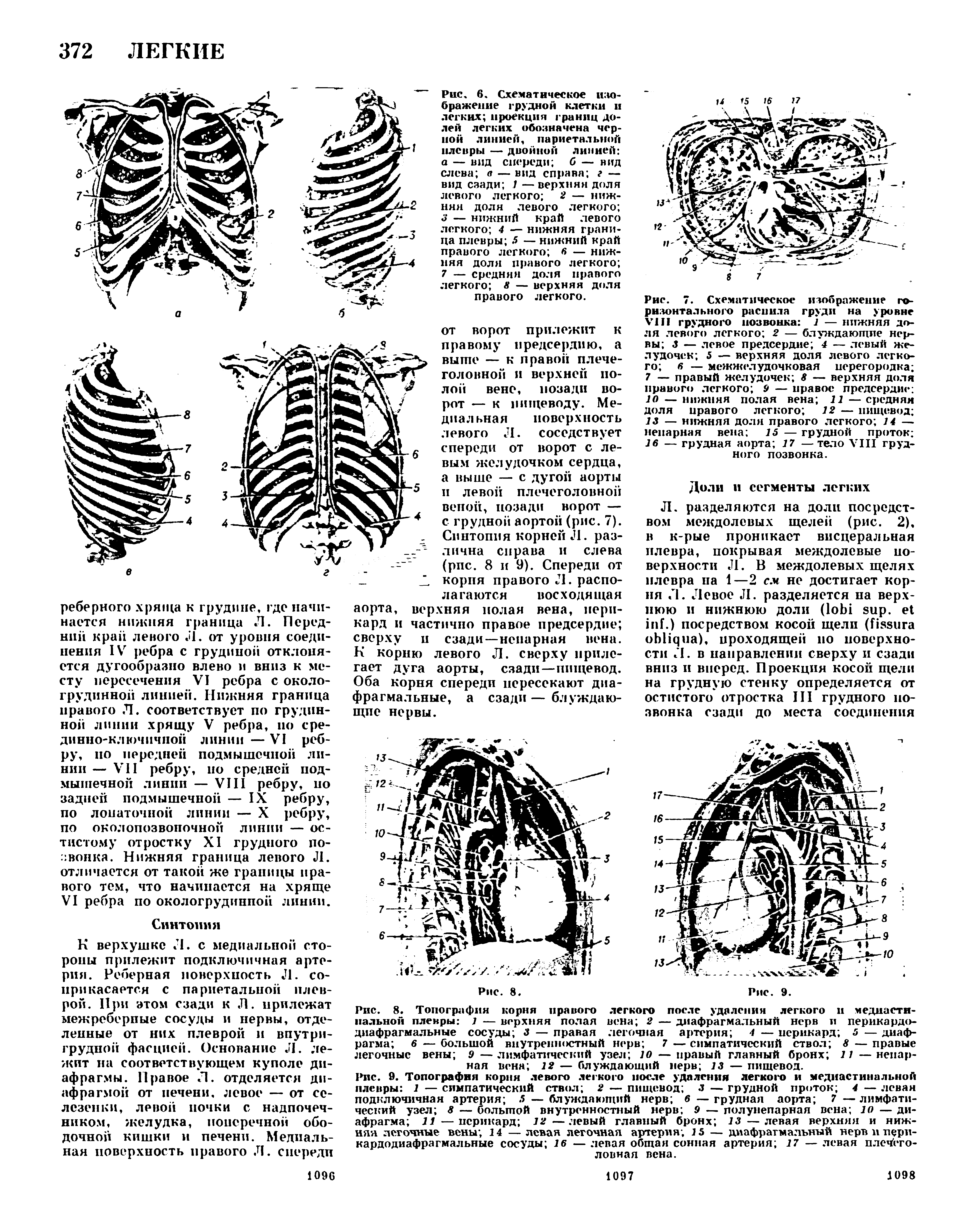 Рис. 8. Топография корня правого легкого после удаления легкого и медиастинальной плевры 1 — верхняя полая вена 2 — диафрагмальный нерв и перикардодиафрагмальные сосуды 3 — правая легочная артерия 4 — перикард 5 — диафрагма 6 — большой внутренностный нерв 7 — симпатический ствол 8 — правые легочные вены 9—лимфатический узел 10— правый главный бронх 11 —непарная вена 12 — блуждающий нерв 13 — пищевод.