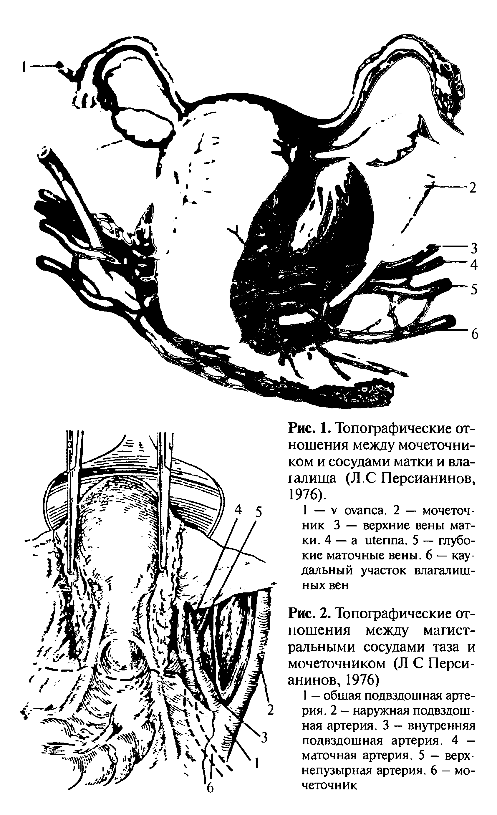 Рис. 1. Топографические отношения между мочеточником и сосудами матки и влагалища (Л.С Персианинов, 1976).