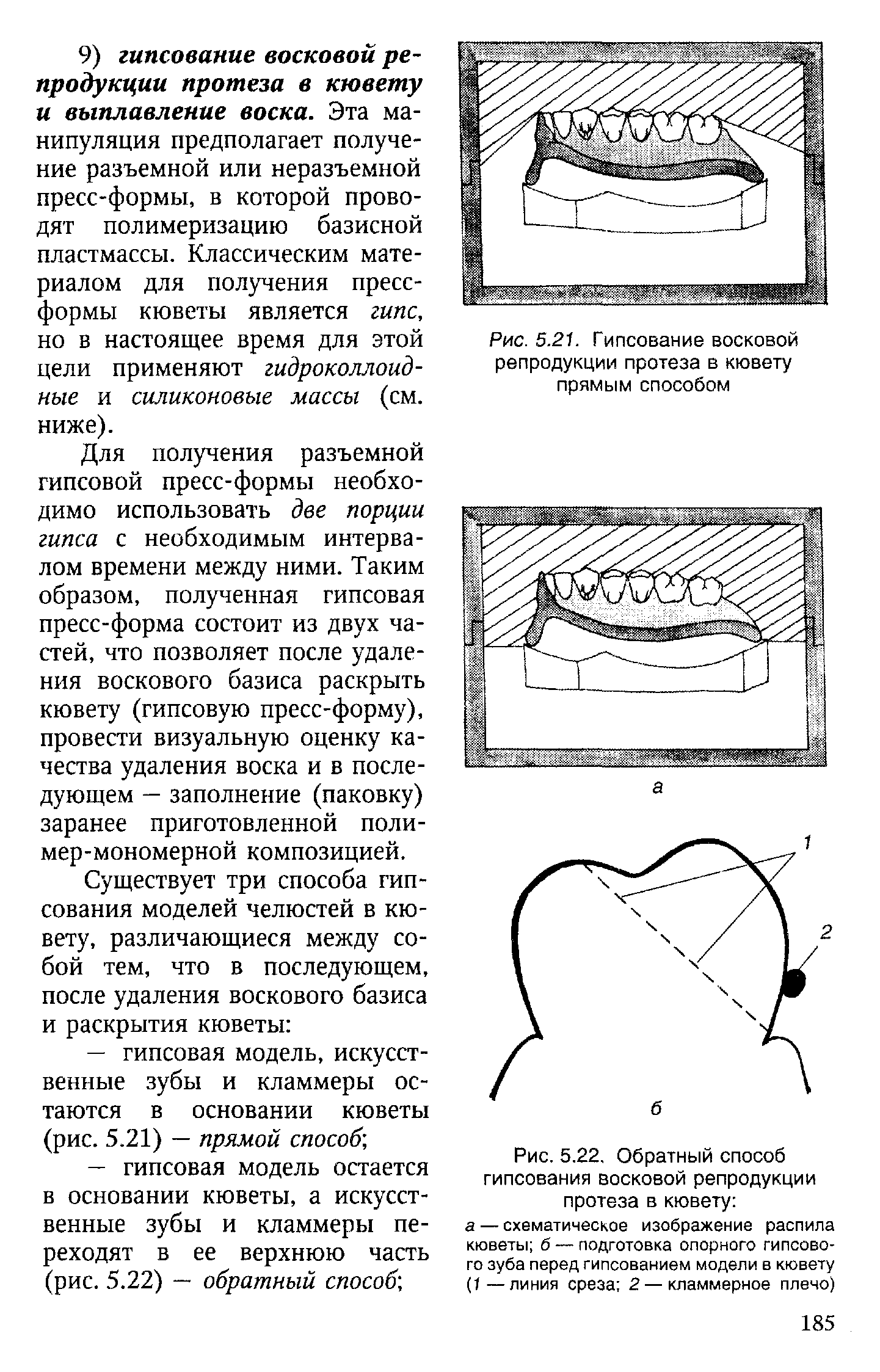 Рис. 5.22. Обратный способ гипсования восковой репродукции протеза в кювету а — схематическое изображение распила кюветы б — подготовка опорного гипсового зуба перед гипсованием модели в кювету (1—линия среза 2 — кламмерное плечо)...