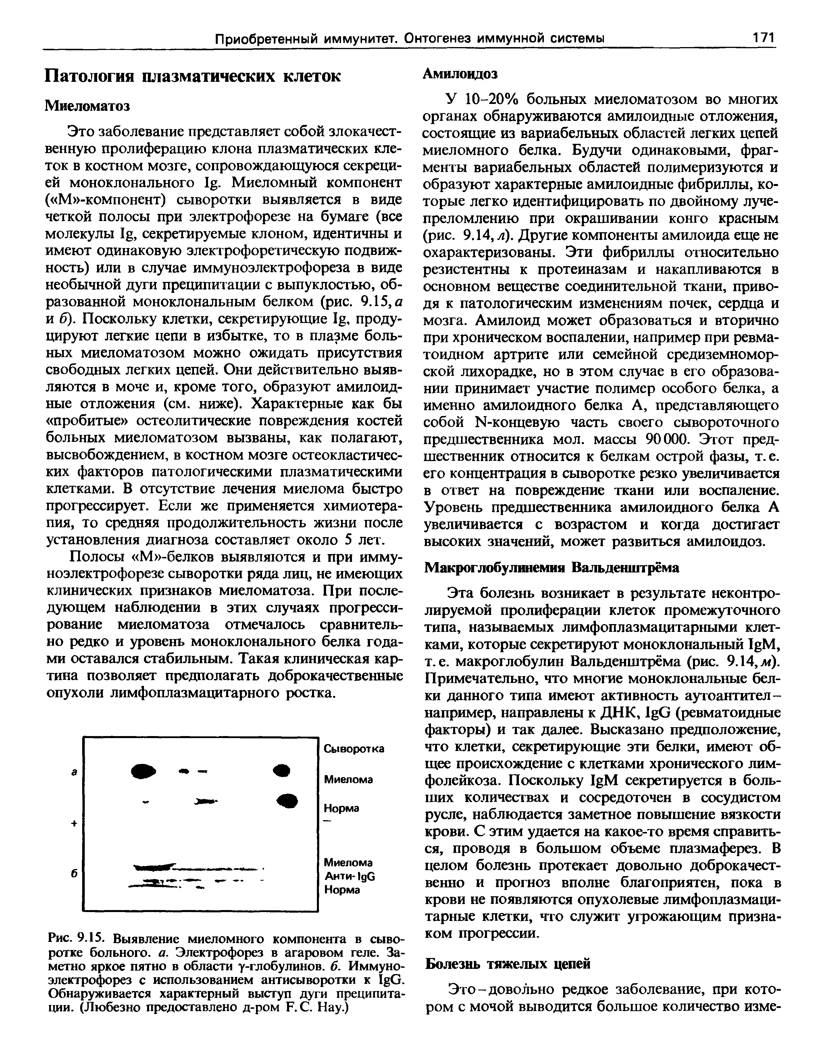 Рис. 9.15. Выявление миеломного компонента в сыворотке больного, а. Электрофорез в агаровом геле. Заметно яркое пятно в области у-глобулинов. б. Иммуноэлектрофорез с использованием антисыворотки к I G. Обнаруживается характерный выступ дуги преципитации. (Любезно предоставлено д-ром F.C. Нау.)...