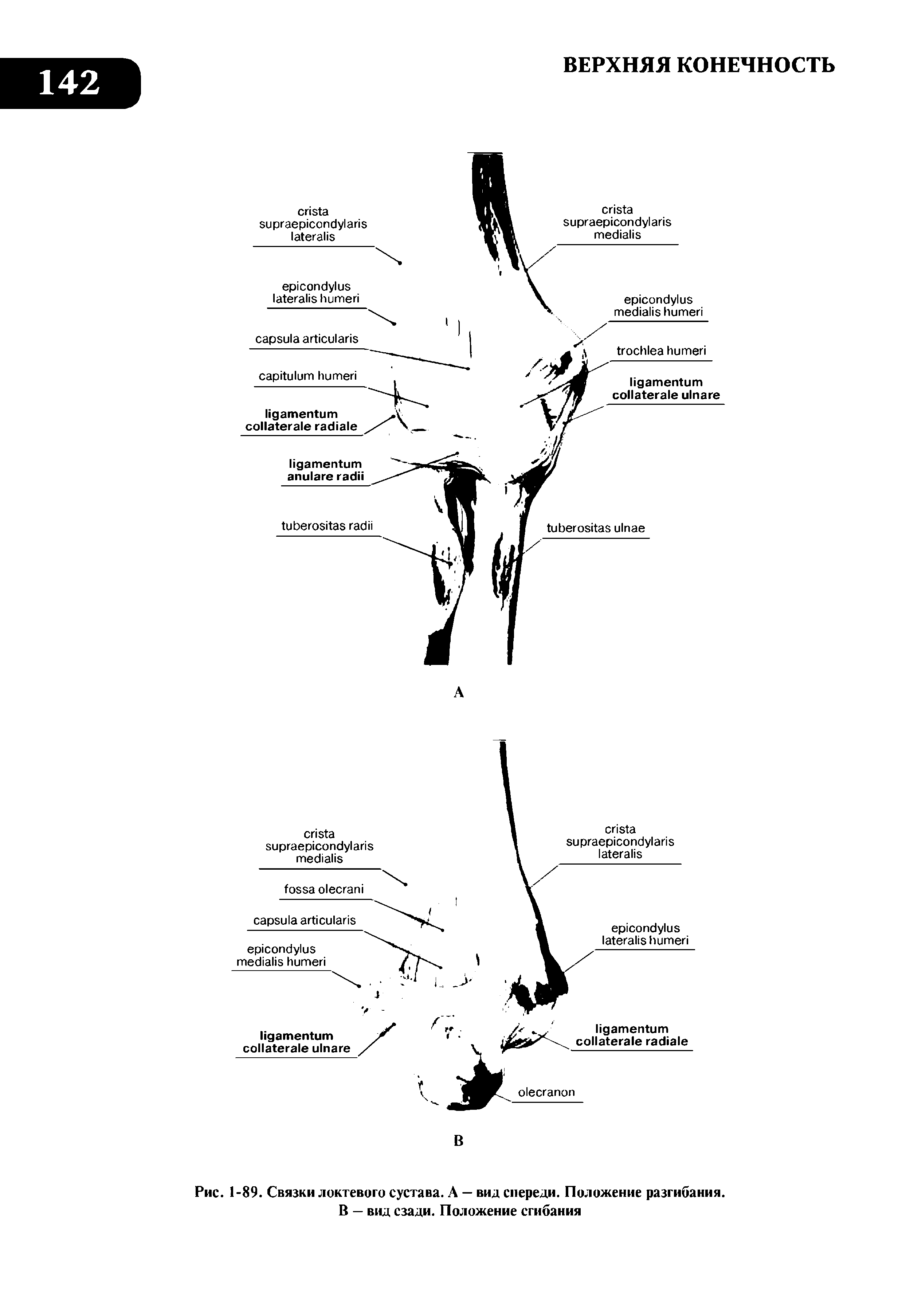 Рис. 1-89. Связки локтевого сустава. А — вид спереди. Положение разгибания. В — вид сзади. Положение сгибания...