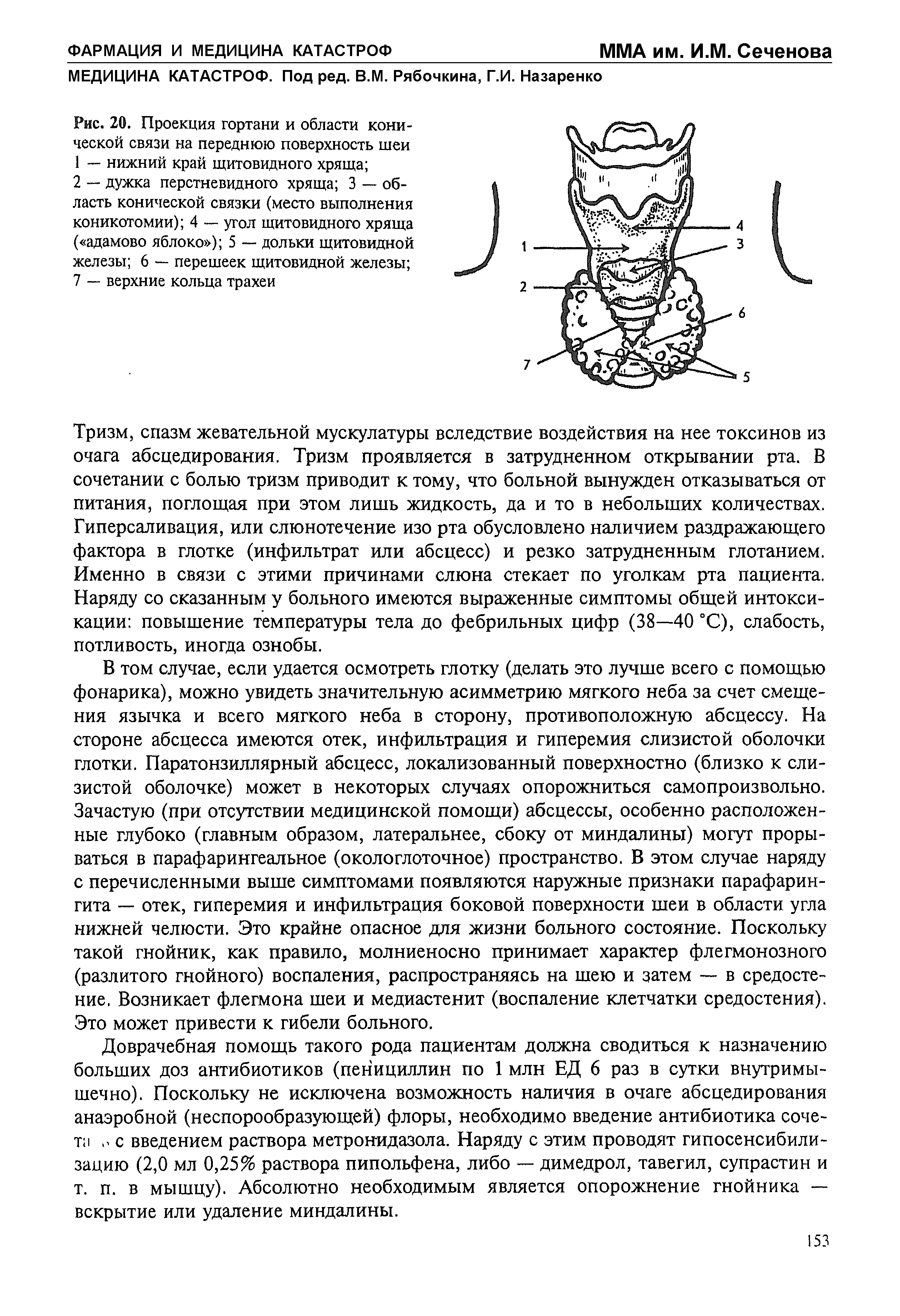 Рис. 20. Проекция гортани и области конической связи на переднюю поверхность шеи...