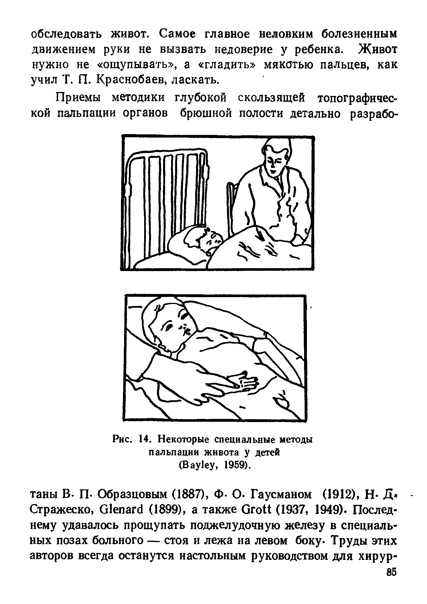 Рис. 14. Некоторые специальные методы пальпации живота у детей (B , 1959).