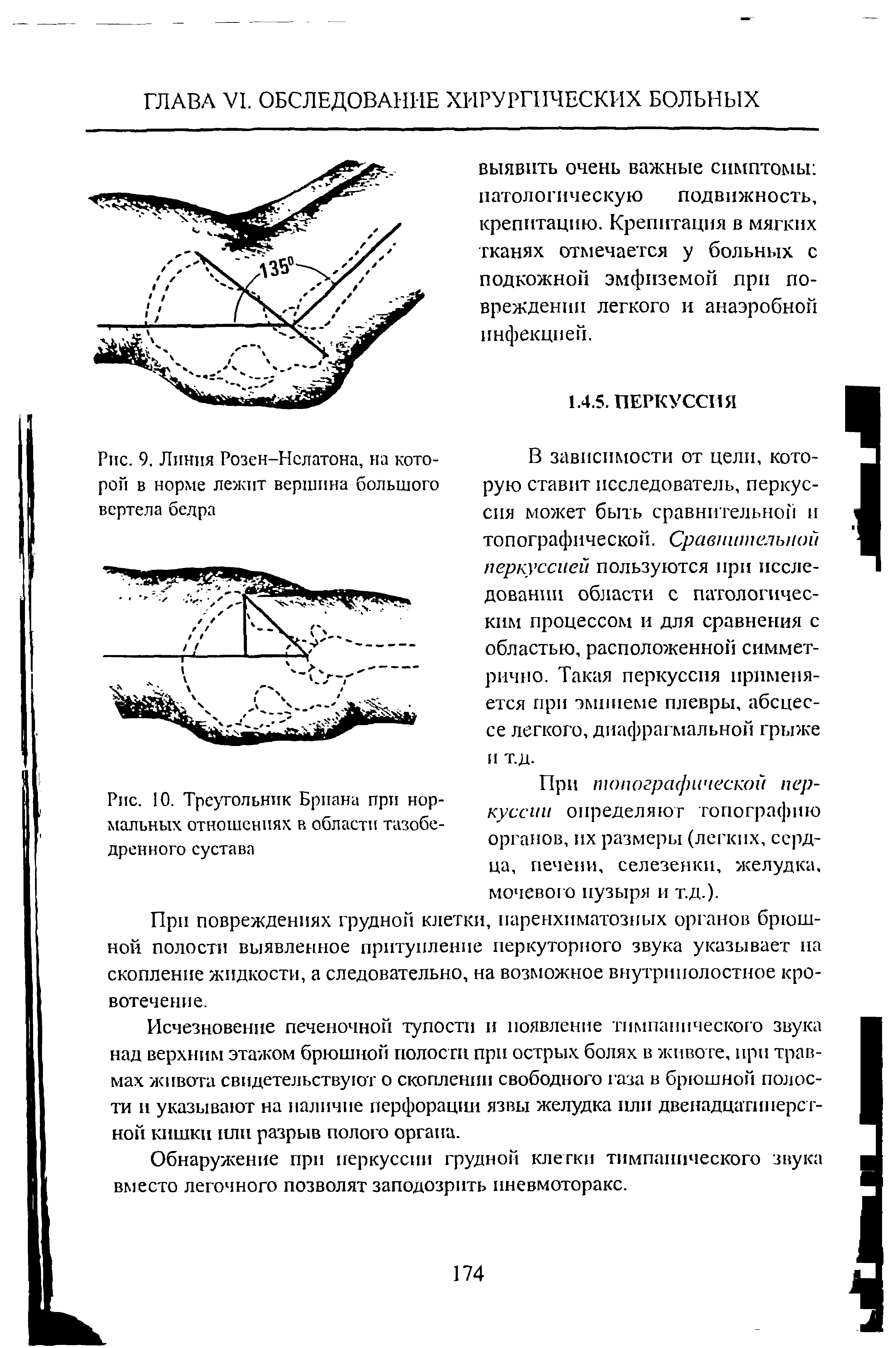 Рис. 10. Треугольник Бриана при нормальных отношениях в области тазобедренного сустава...