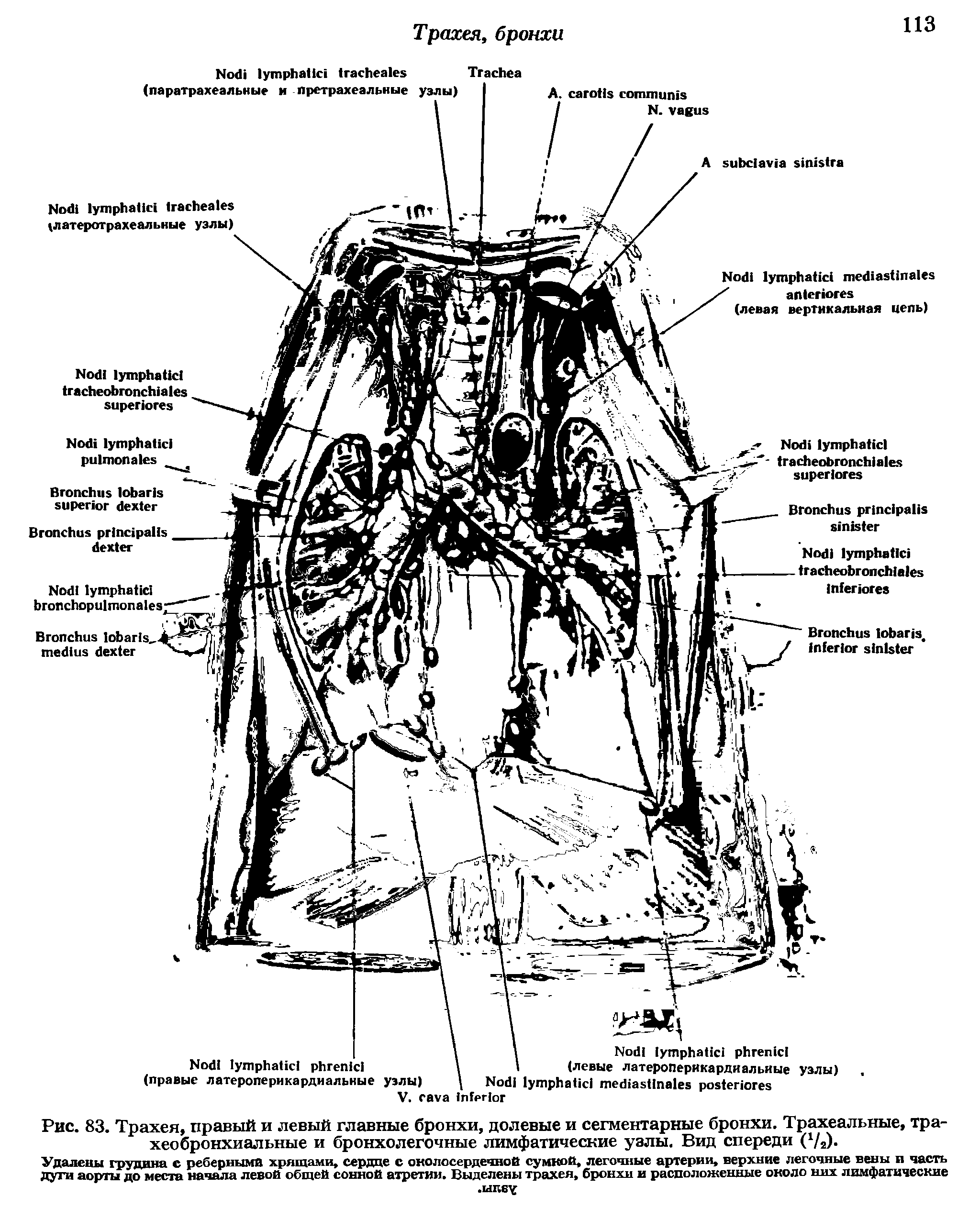 Рис. 83. Трахея, правый и левый главные бронхи, долевые и сегментарные бронхи. Трахеальные, трахеобронхиальные и бронхолегочные лимфатические узлы. Вид спереди (1/2).