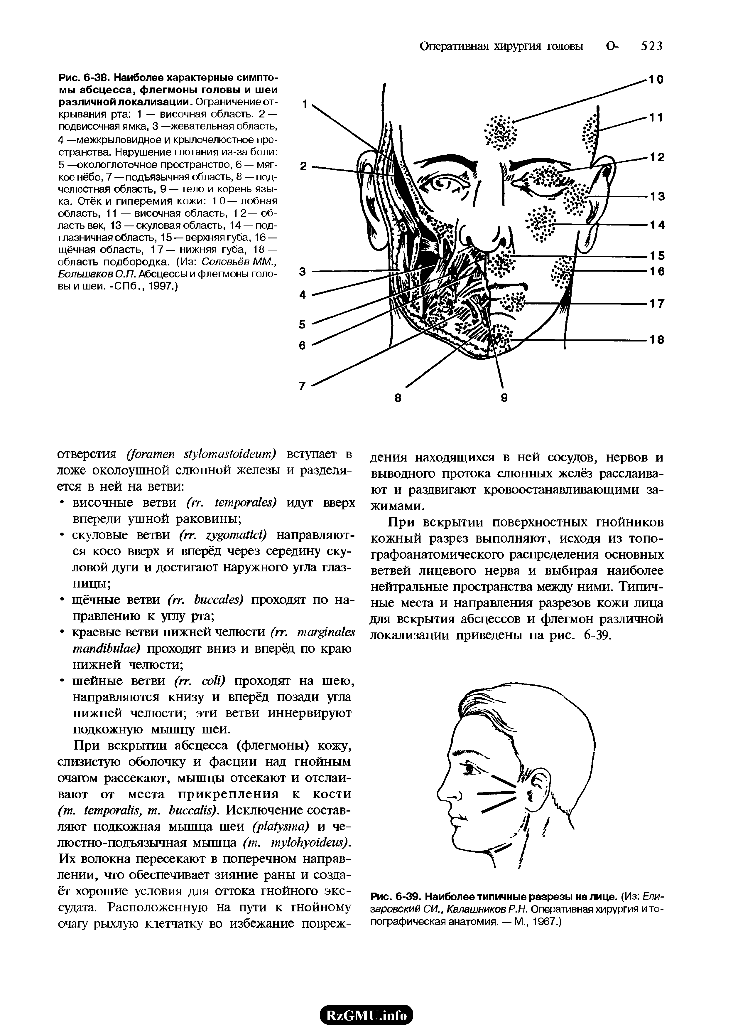 Рис. 6-39. Наиболее типичные разрезы на лице. (Из Елизаровский СИ., Калашников Р.Н. Оперативная хирургия и топографическая анатомия. — М., 1967.)...