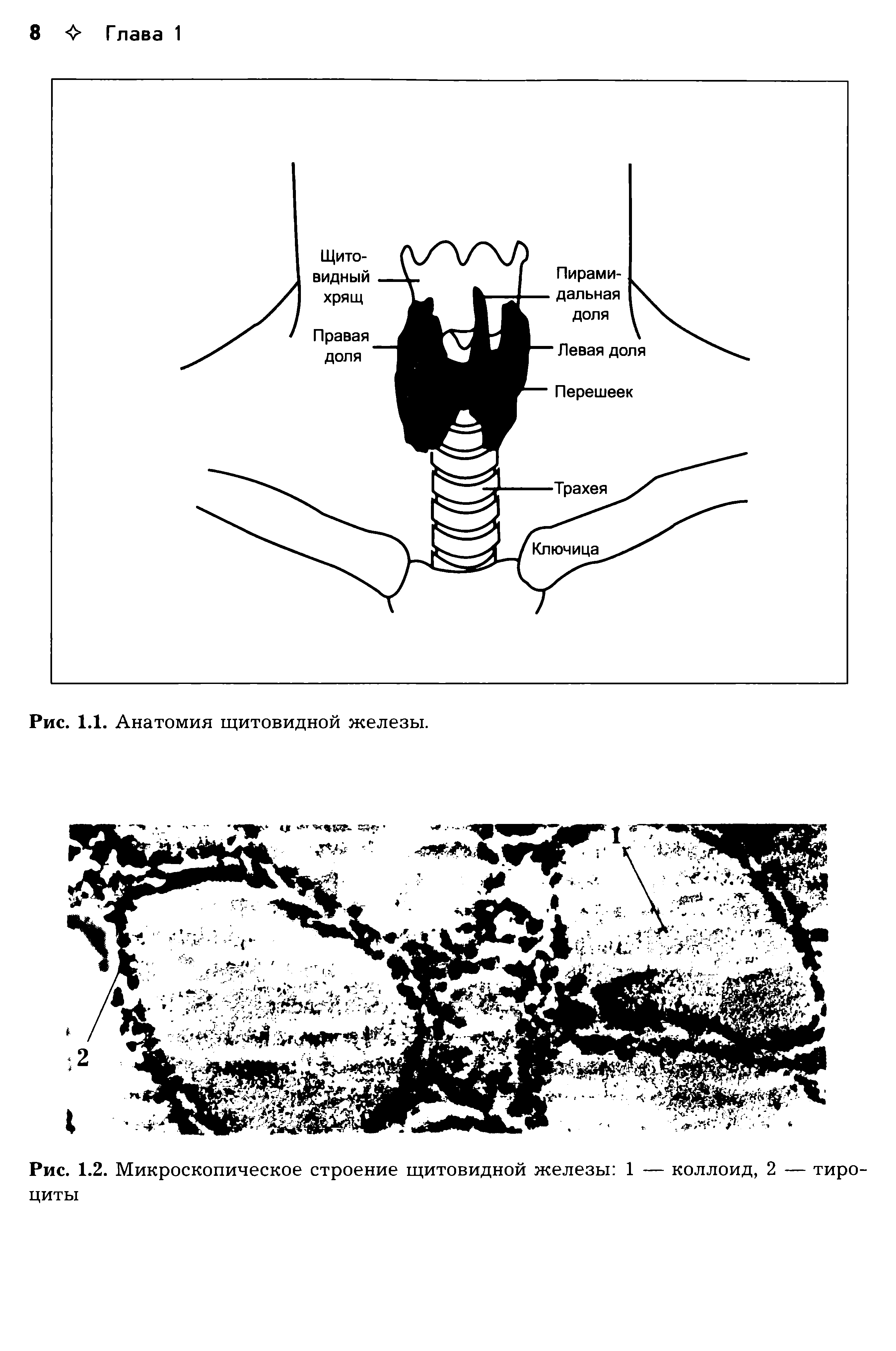 Рис. 1.2. Микроскопическое строение щитовидной железы 1 — коллоид, 2 — тиро-циты...