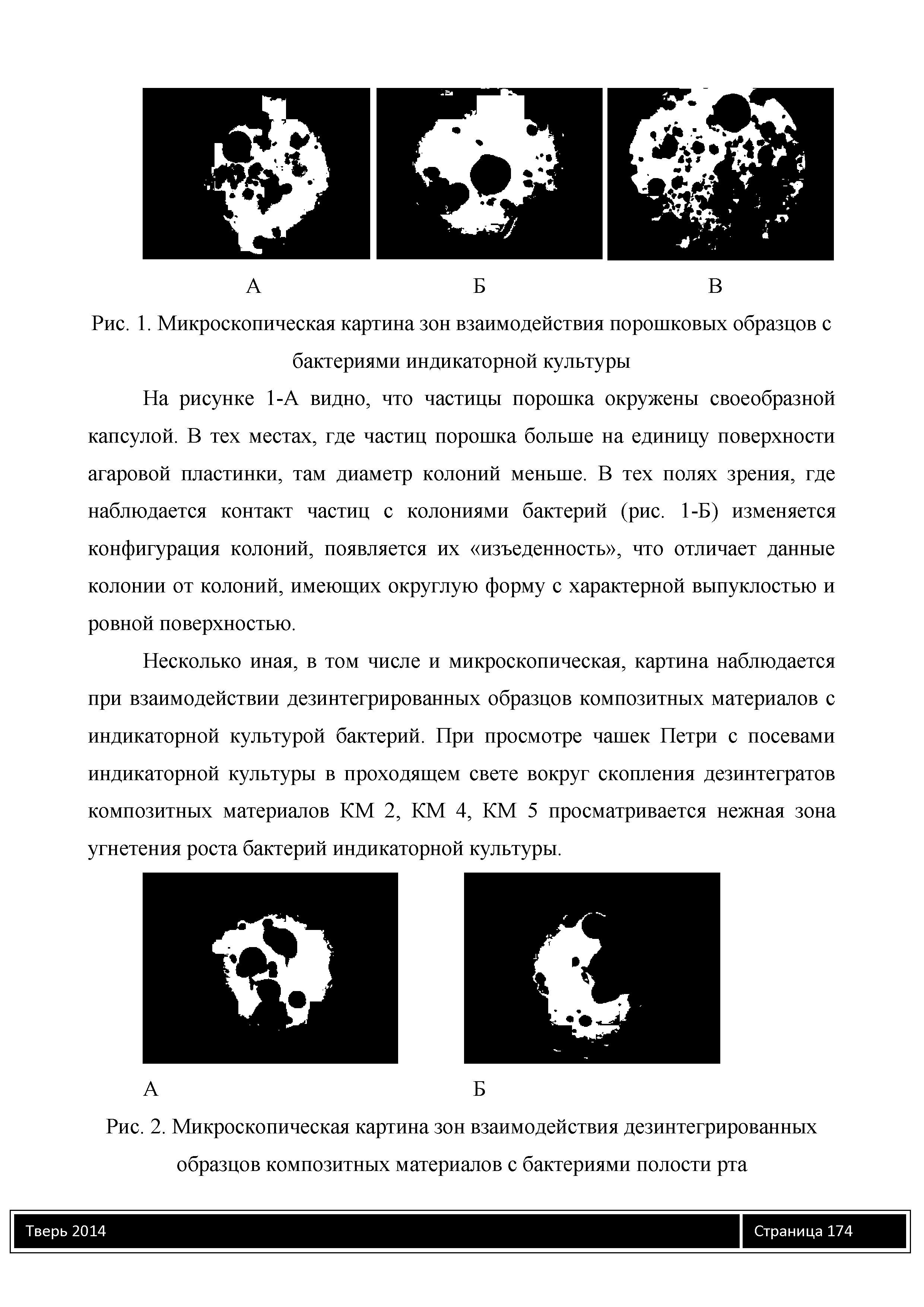 Рис. 1. Микроскопическая картина зон взаимодействия порошковых образцов с бактериями индикаторной культуры...