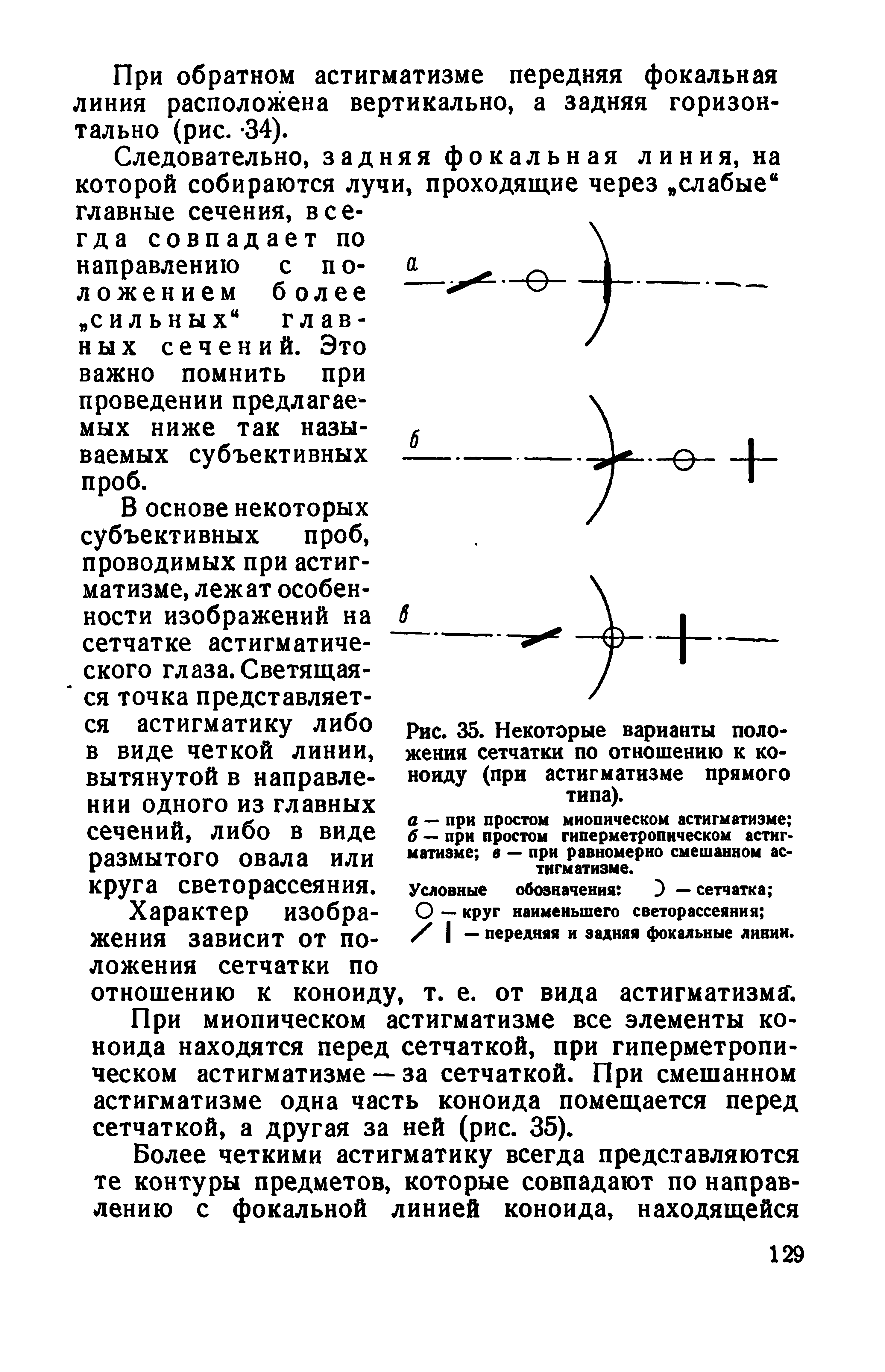 Рис. 35. Некоторые варианты положения сетчатки по отношению к коноиду (при астигматизме прямого типа).