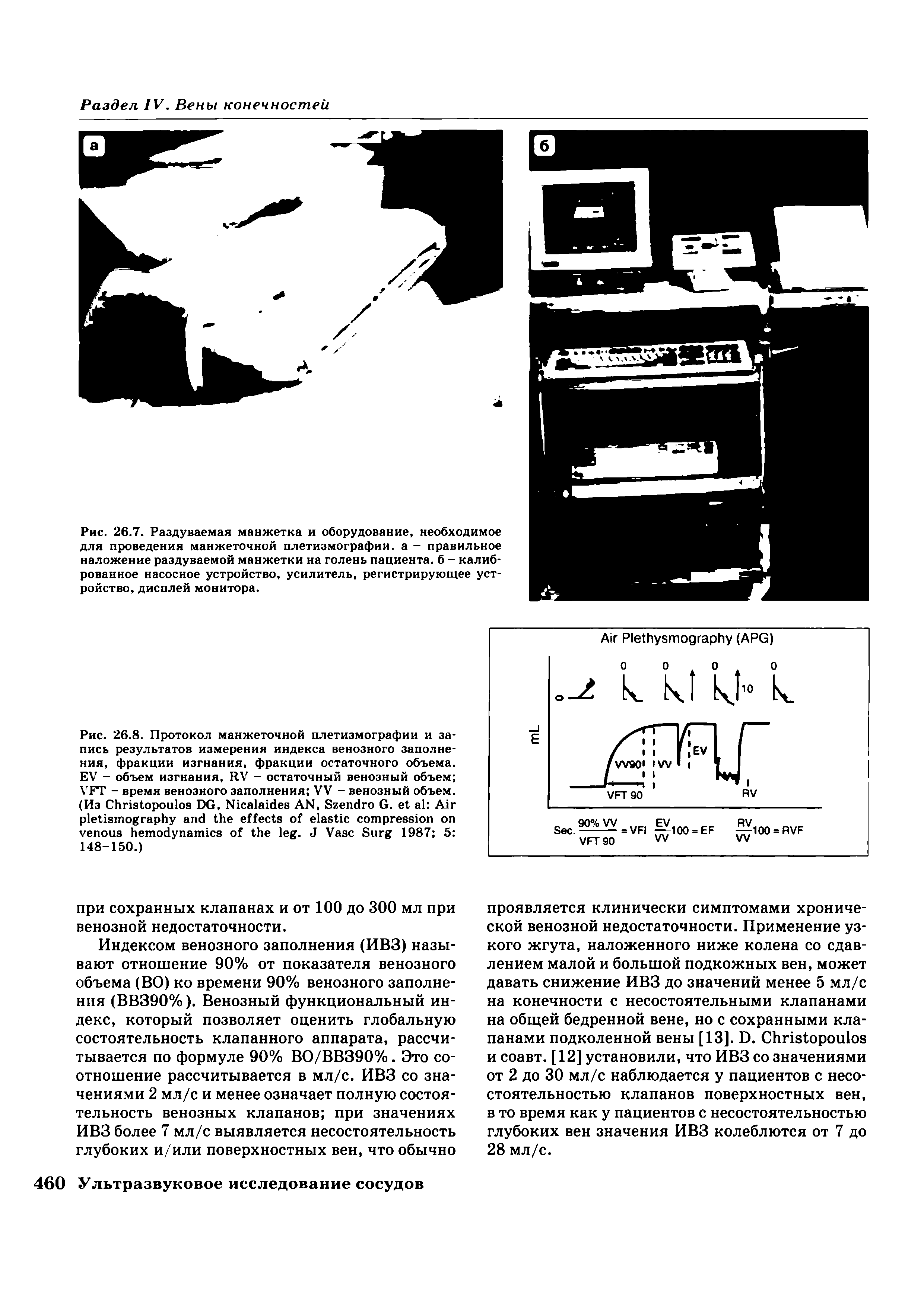 Рис. 26.7. Раздуваемая манжетка и оборудование, необходимое для проведения манжеточной плетизмографии, а - правильное наложение раздуваемой манжетки на голень пациента, б - калиброванное насосное устройство, усилитель, регистрирующее ройство, дисплей монитора.