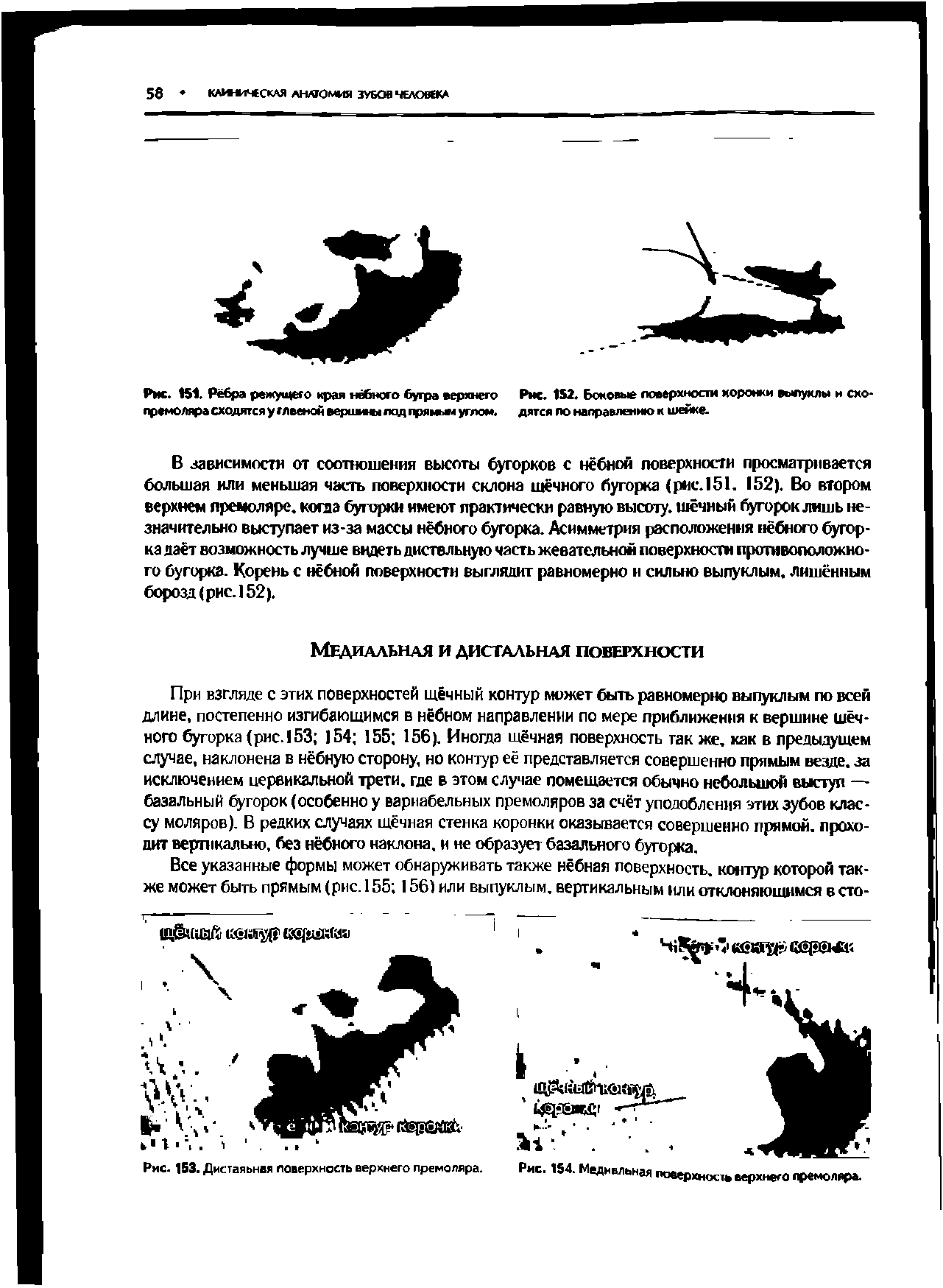 Рис. 151. Рёбра режущего края нёбного бугра верхнего Рис. 152. Боковые поверхности коронки выпуклы и схо-премоляра сходятся у главной вершины под прямом углом, дятся по направлению к шейке.