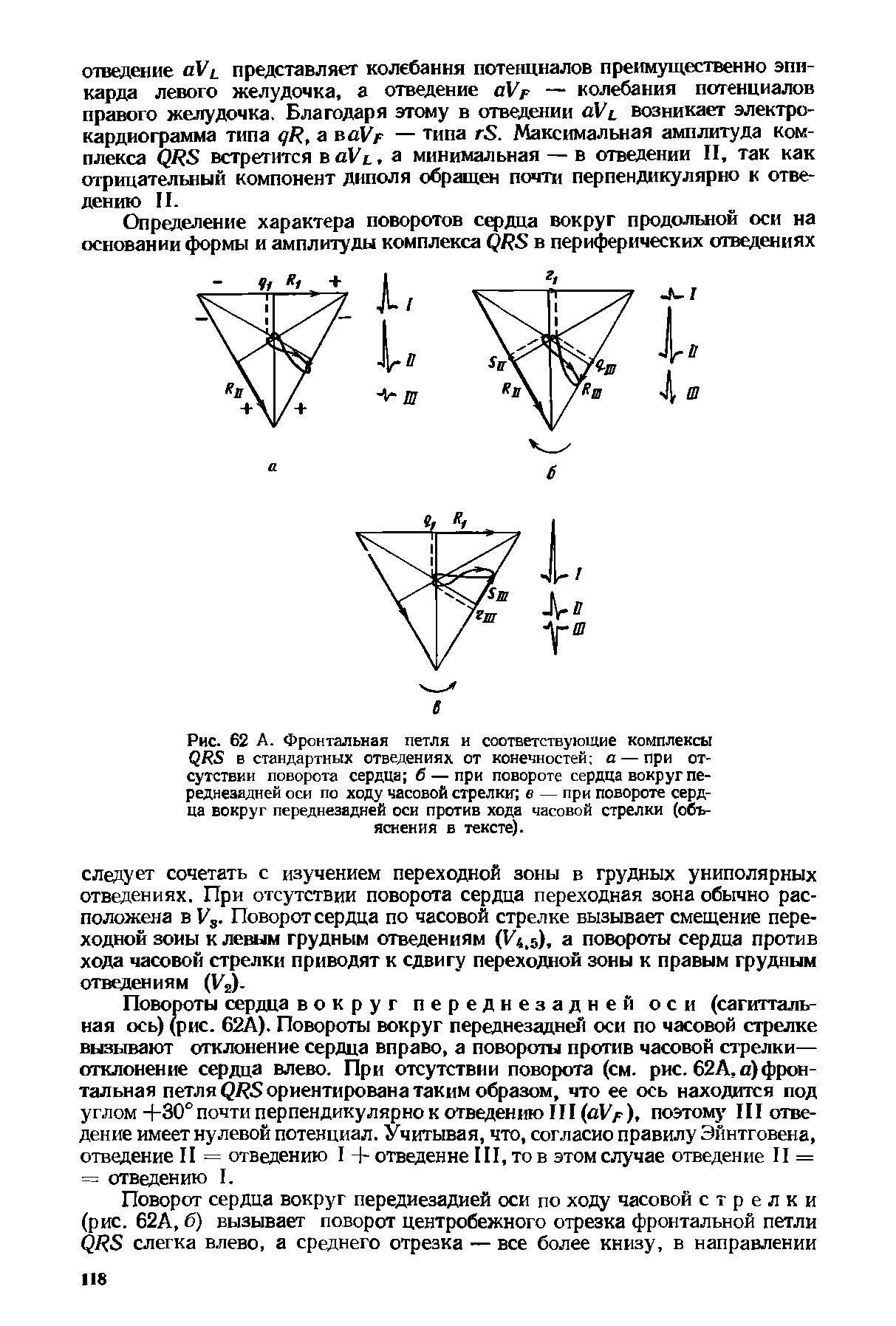 Рис. 62 А. Фронтальная петля и соответствующие комплексы ( Ю в стандартных отведениях от конечностей а — при отсутствии поворота сердца б — при повороте сердца вокруг переднезадней оси по ходу часовой стрелки в — при повороте сердца вокруг переднезадней оси против хода часовой стрелки (объяснения в тексте).