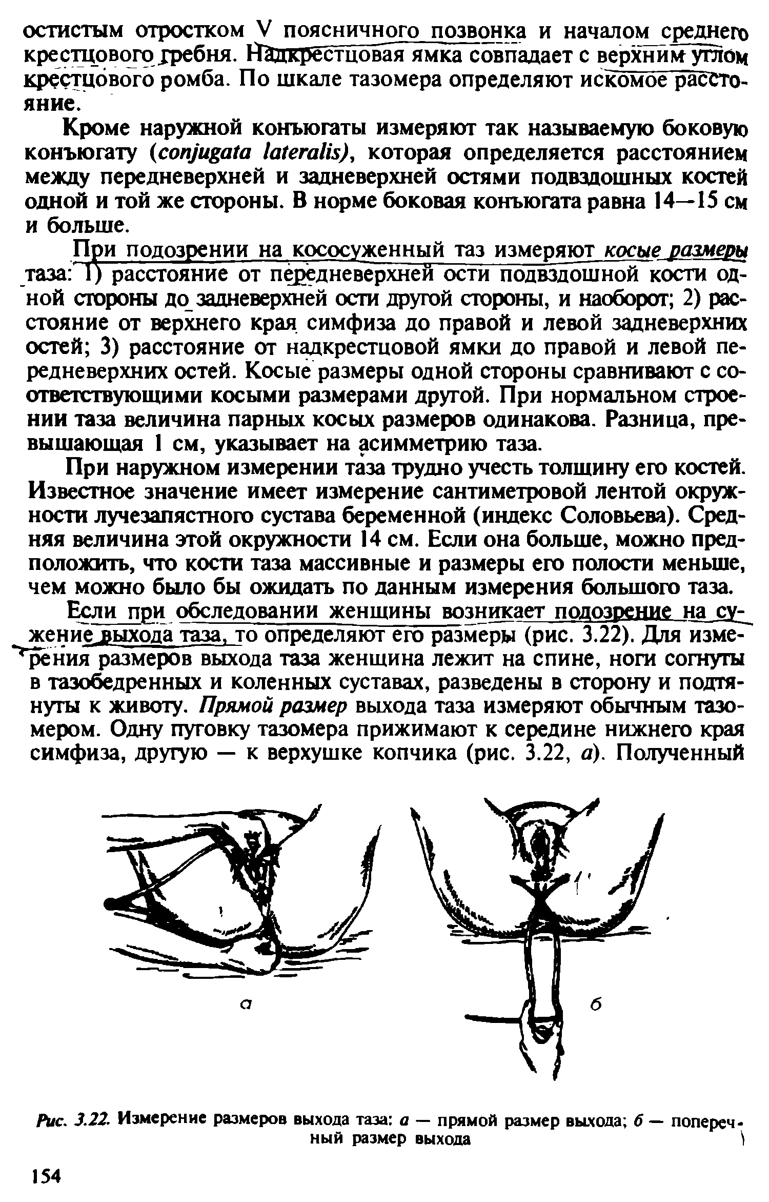 Рис. 3.22. Измерение размеров выхода таза а — прямой размер выхода б — поперечный размер выхода...