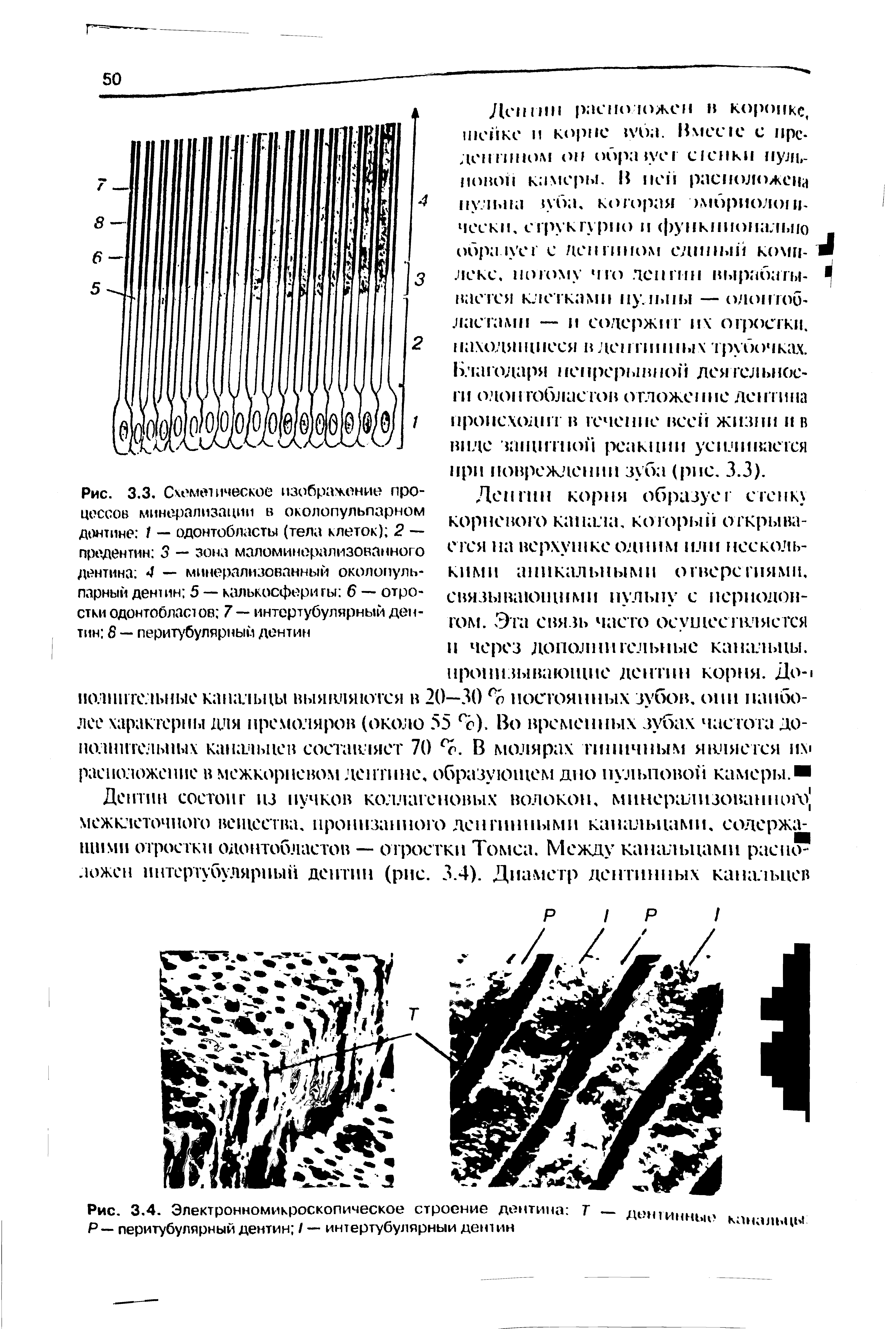 Рис. 3.4. Электронномикроскопическое строение дентина Р — перитубулярный дентин / — интертубулярныи детин...