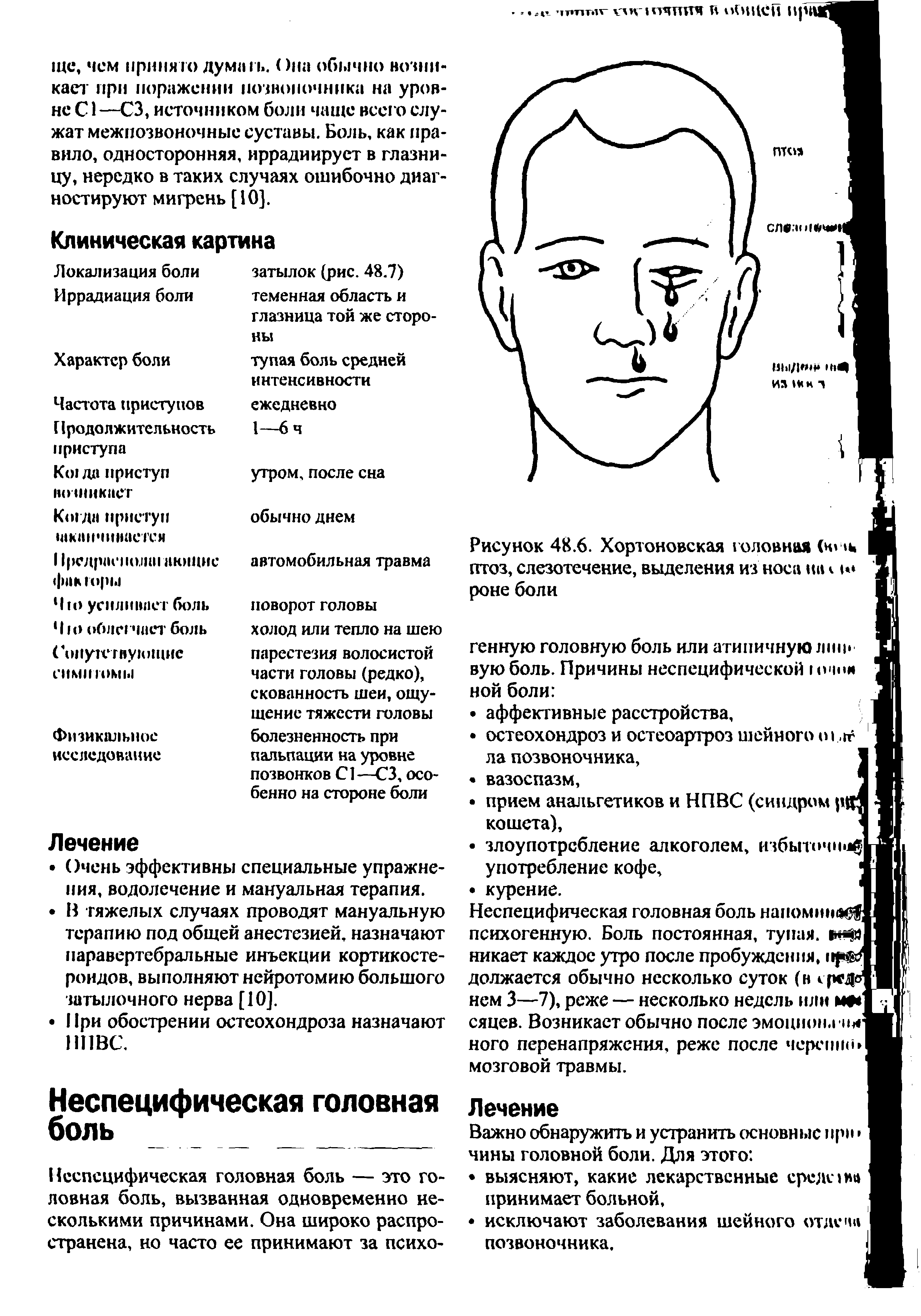 Рисунок 48.6. Хортоновская головная (кг ь птоз, слезотечение, выделения из носа па < и ...