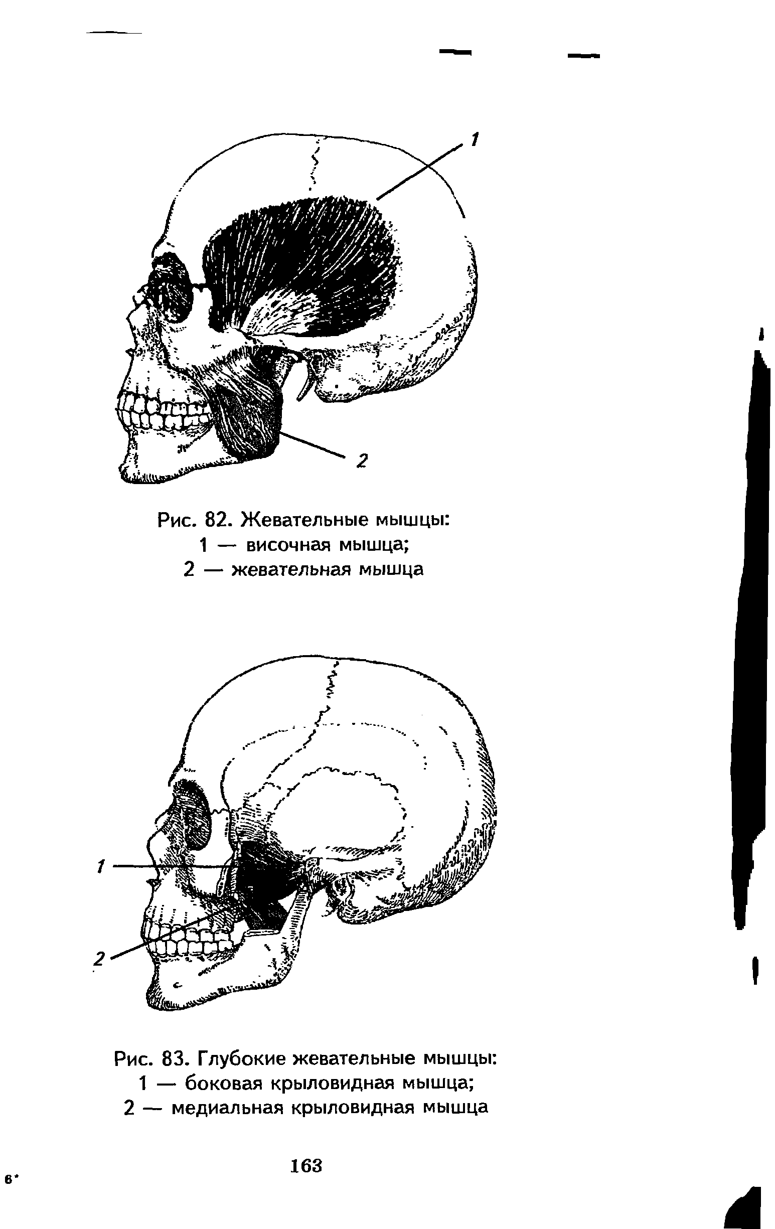 Рис. 83. Глубокие жевательные мышцы 1 — боковая крыловидная мышца ...