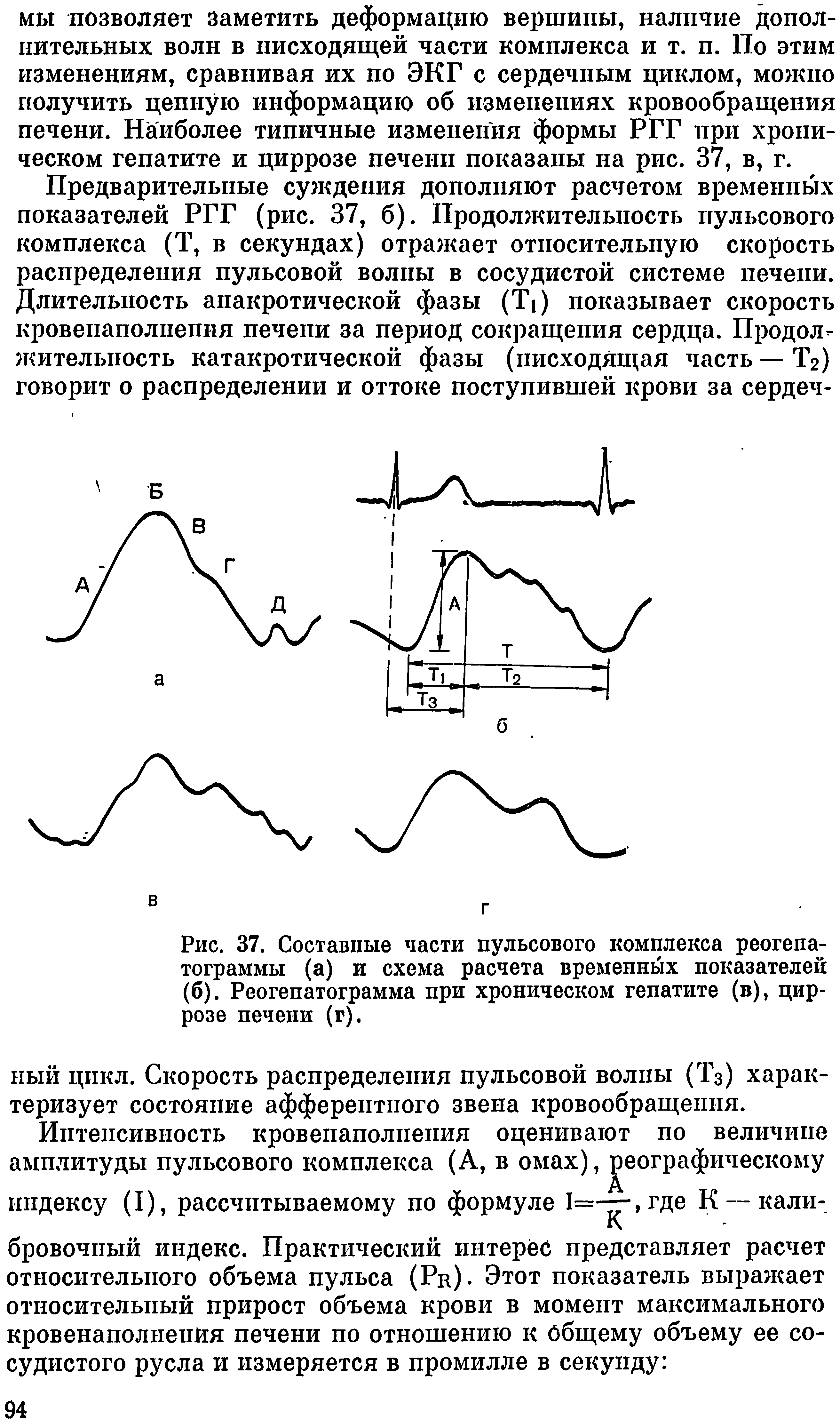 Рис. 37. Составные части пульсового комплекса реогепа-тограммы (а) и схема расчета временных показателей (б). Реогепатограмма при хроническом гепатите (в), циррозе печени (г).