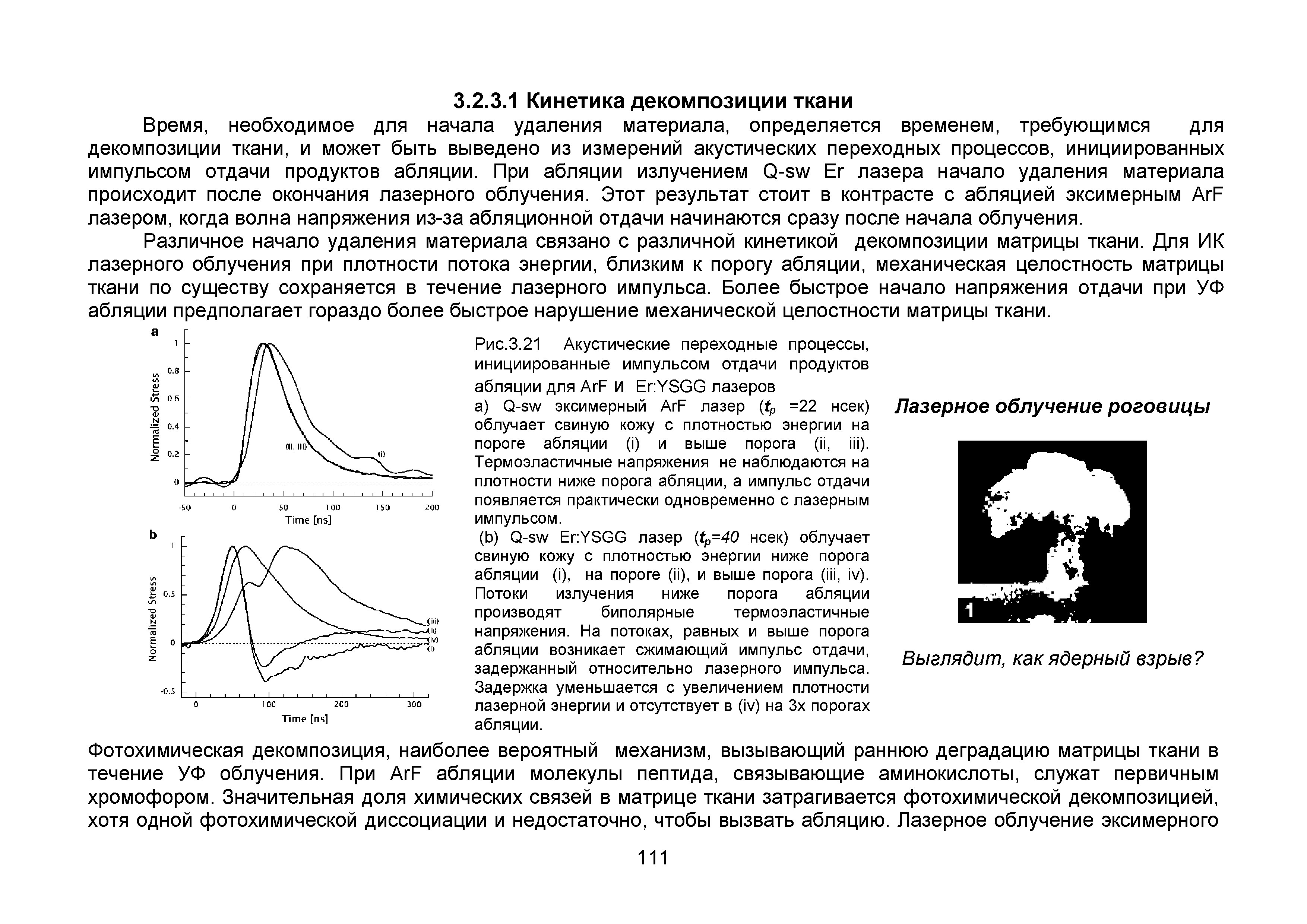 Рис.3.21 Акустические переходные процессы, инициированные импульсом отдачи продуктов абляции для АгР И ЕпУБСС лазеров...