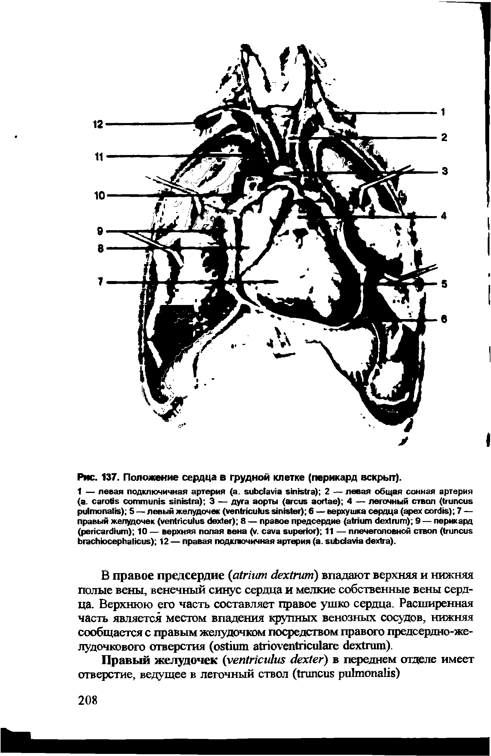 Рис. 137. Положение сердца в грудной клетке (перикард вскрыт).