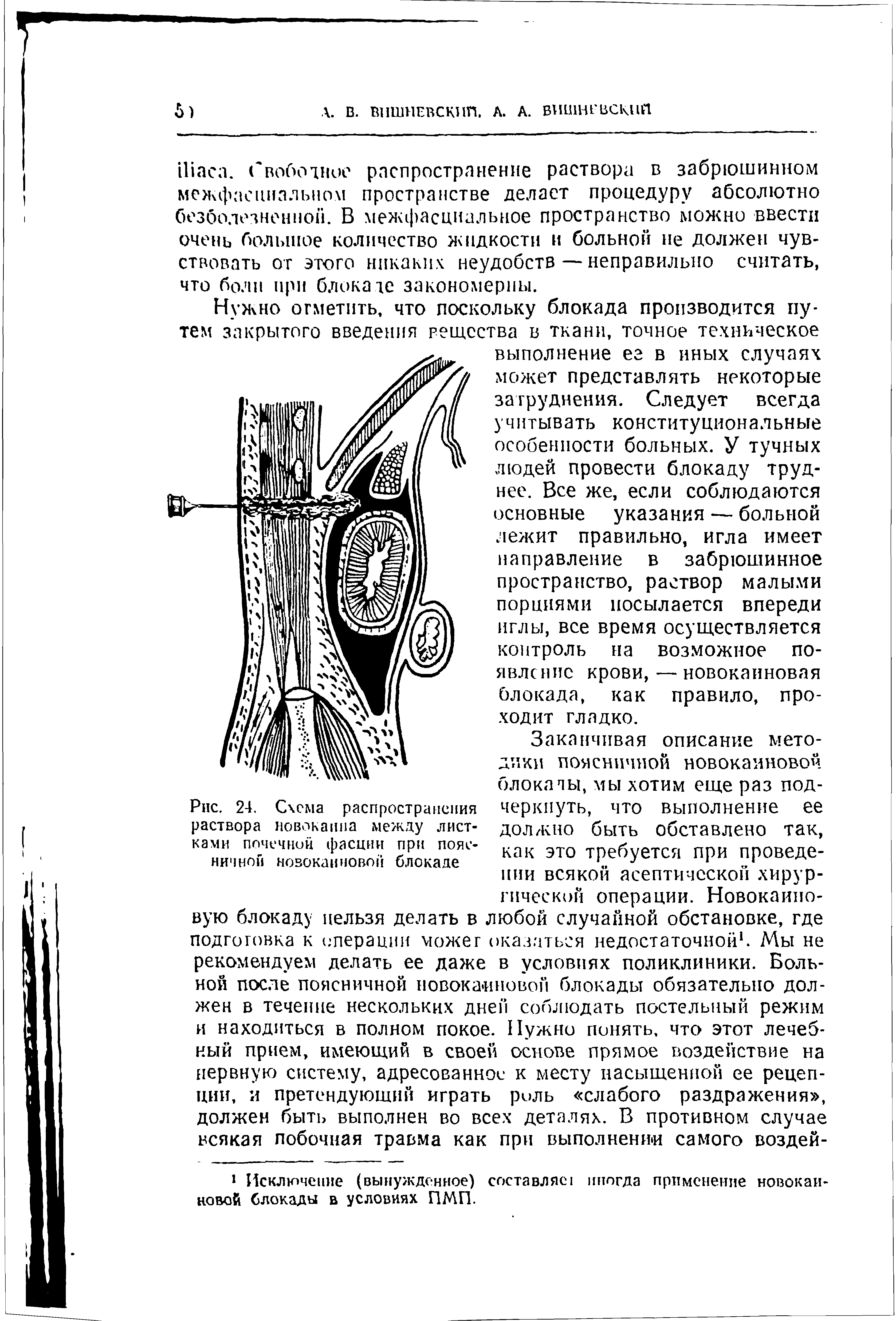 Рис. 24. Схема распространения раствора новокаина между листками почечной фасции при поясничной новокаиновой блокаде...