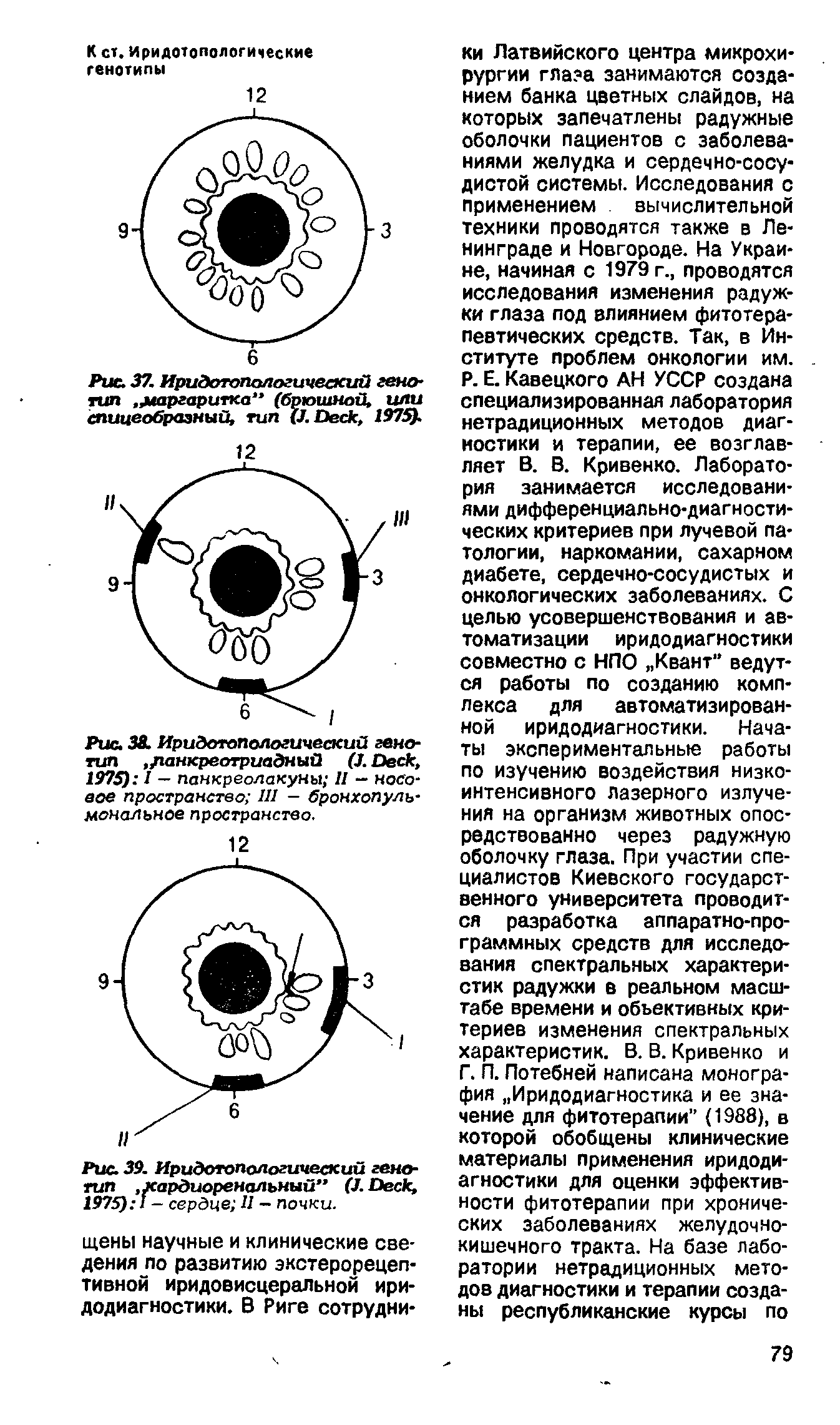 Рис. 39. Иридотопологический генотип. хардиоренальный" (J. D , 1975) I — сердце II — почки.