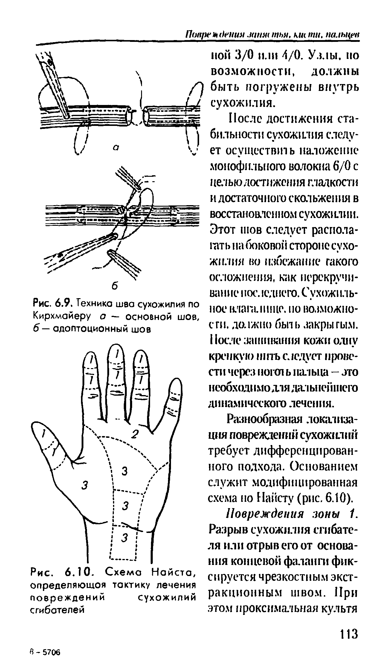 Рис. 6.10. Схема Найста, определяющая тактику лечения повреждений сухожилий...