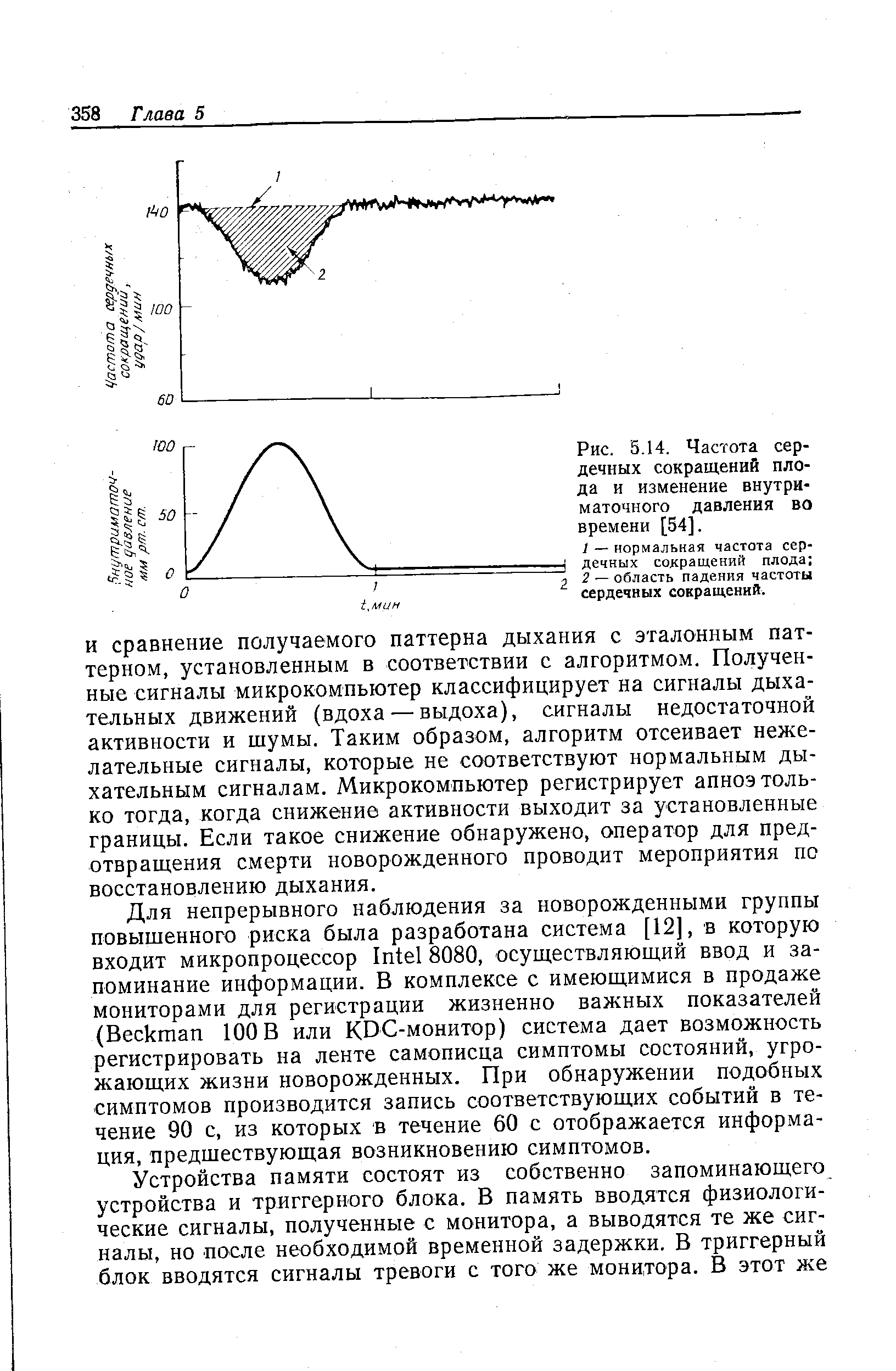 Рис. 5.14. Частота сердечных сокращений плода и изменение внутри-маточного давления во времени [54].