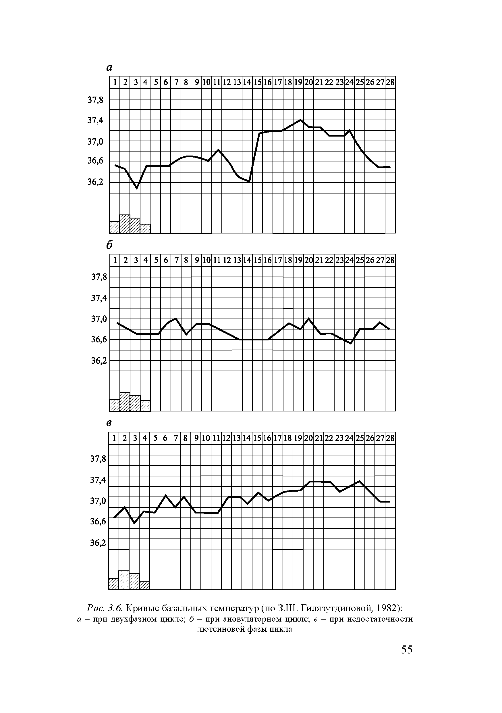 Рис. 3.6. Кривые базальных температур (по З.Ш. Гилязутдиновой, 1982) а - при двухфазном цикле б - при ановуляторном цикле в - при недостаточности лютеиновой фазы цикла...