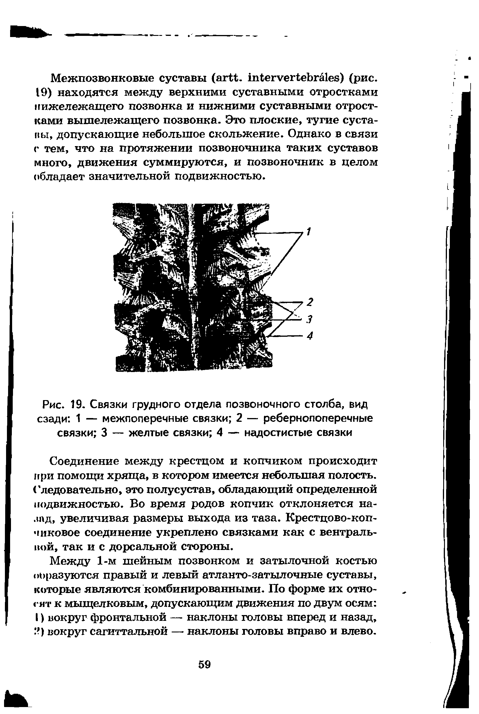 Рис. 19. Связки грудного отдела позвоночного столба, вид сзади 1 — межпоперечные связки 2 — ребернопоперечные связки 3 — желтые связки 4 — надостистые связки...