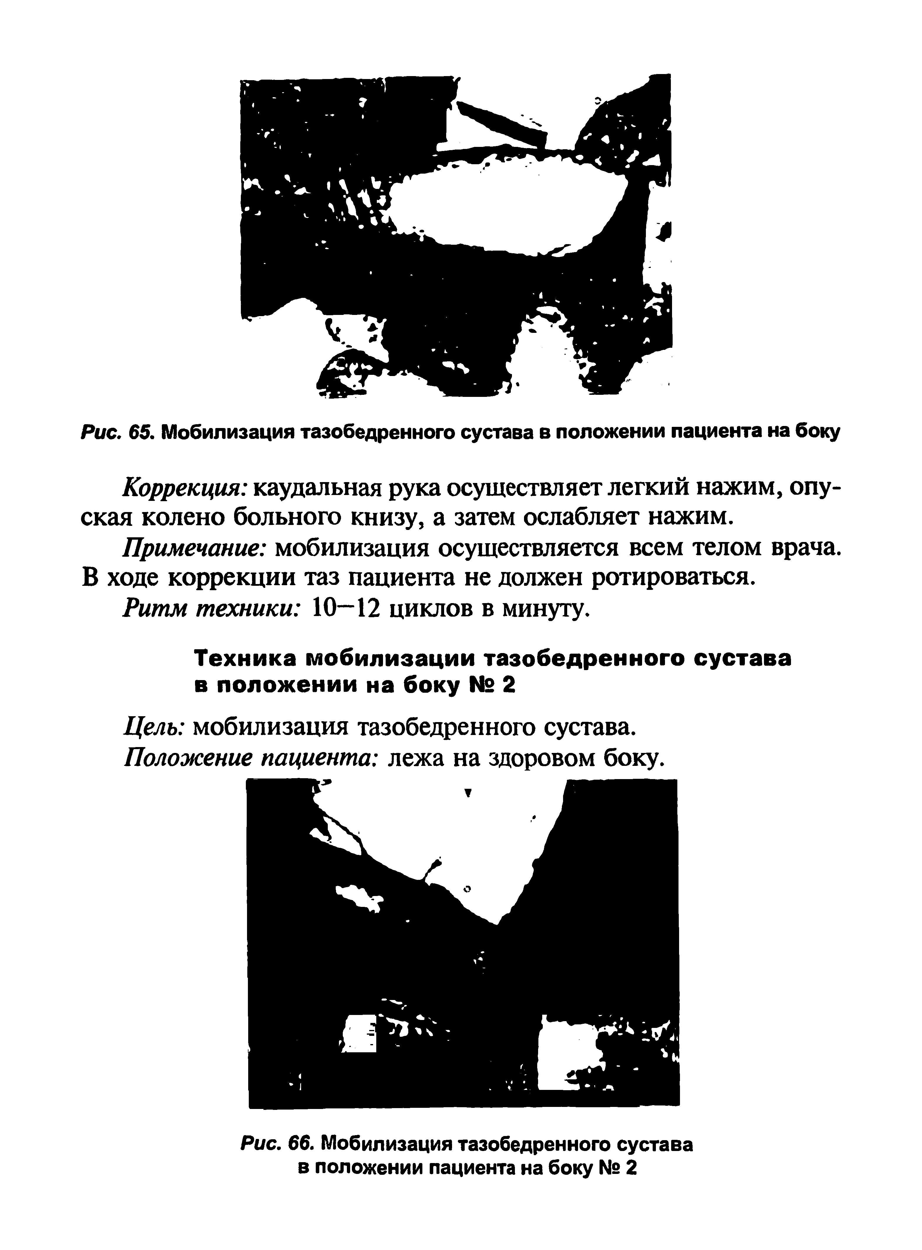 Рис. 66. Мобилизация тазобедренного сустава в положении пациента на боку № 2...