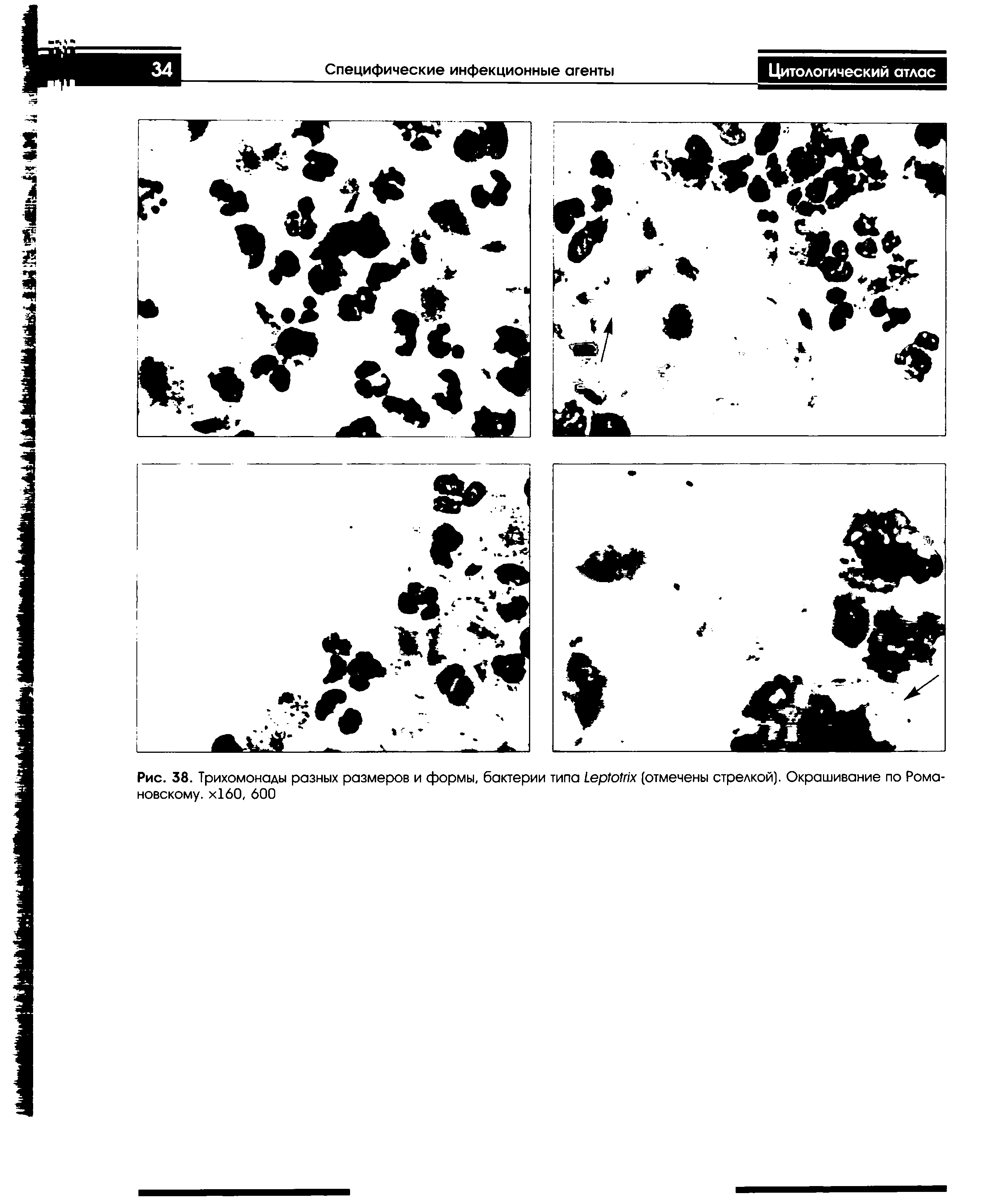 Рис. 38. Трихомонады разных размеров и формы, бактерии типа ЬерЮМх (отмечены стрелкой). Окрашивание по Романовскому. х160, 600...