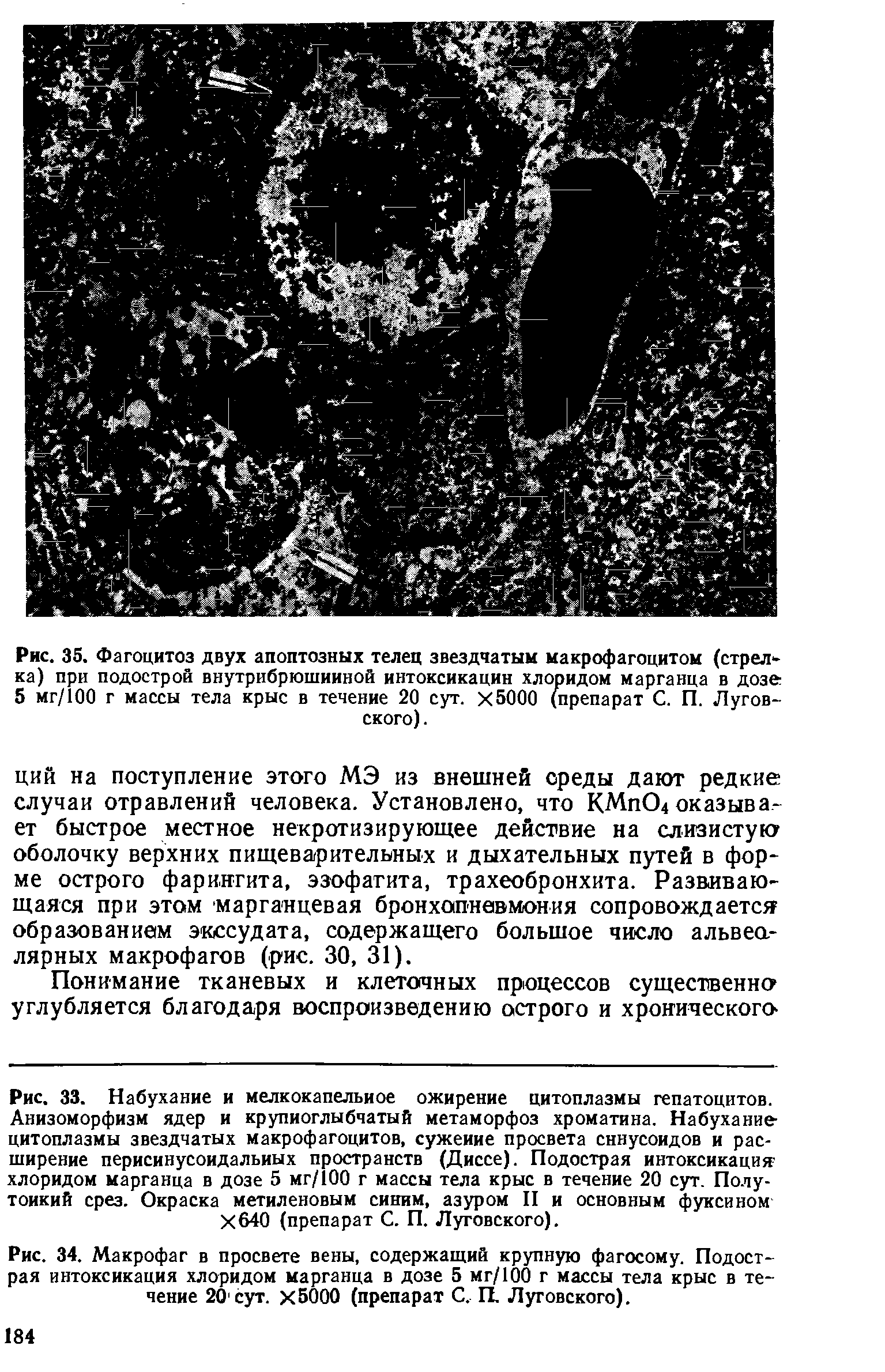 Рис. 34. Макрофаг в просвете вены, содержащий крупную фагосому. Подострая интоксикация хлоридом марганца в дозе 5 мг/100 г массы тела крыс в течение 20 сут. Х5000 (препарат С. П. Луговского).