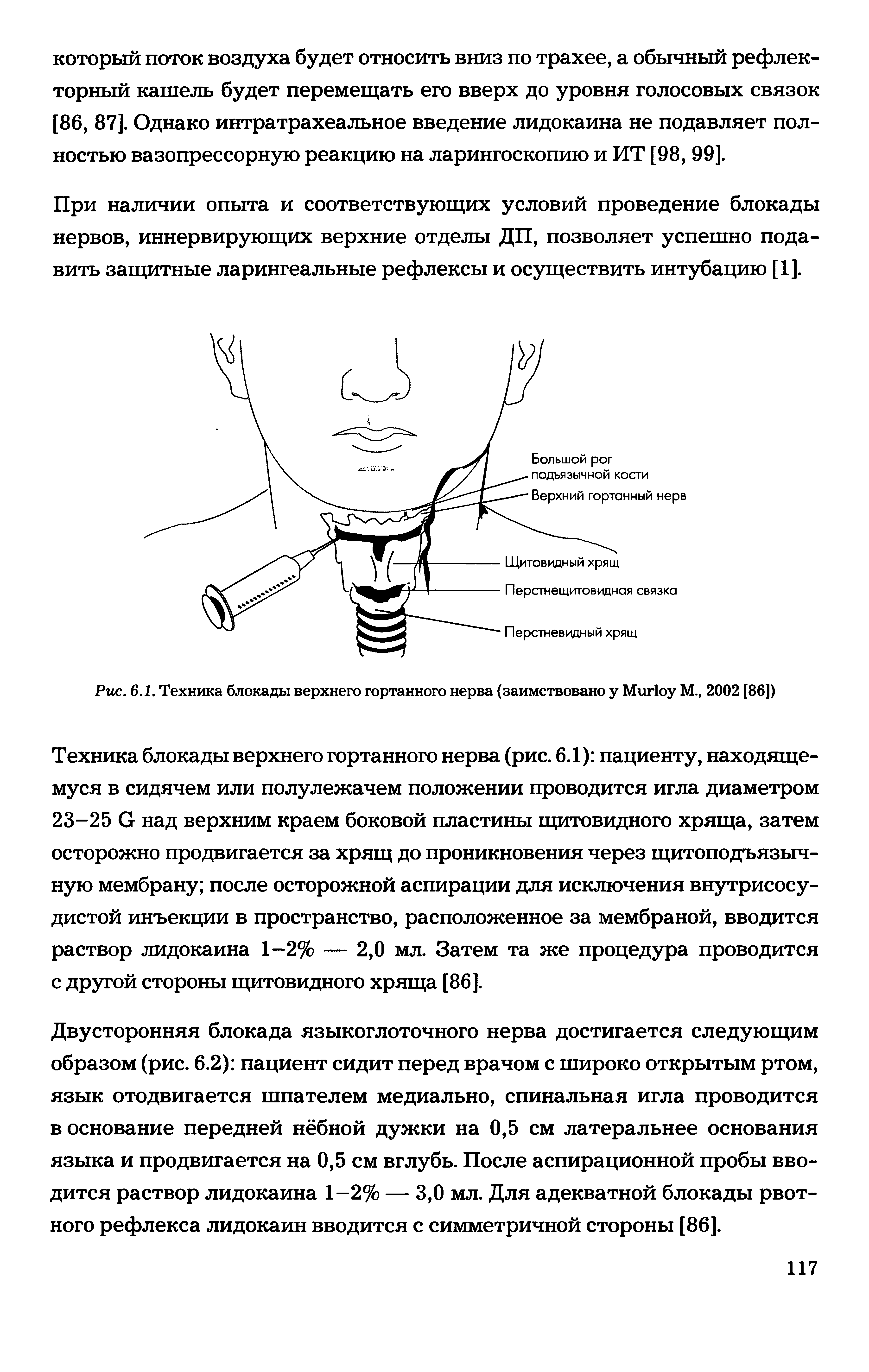 Рис. 6.1. Техника блокады верхнего гортанного нерва (заимствовано у Миг1оу М., 2002 [86])...