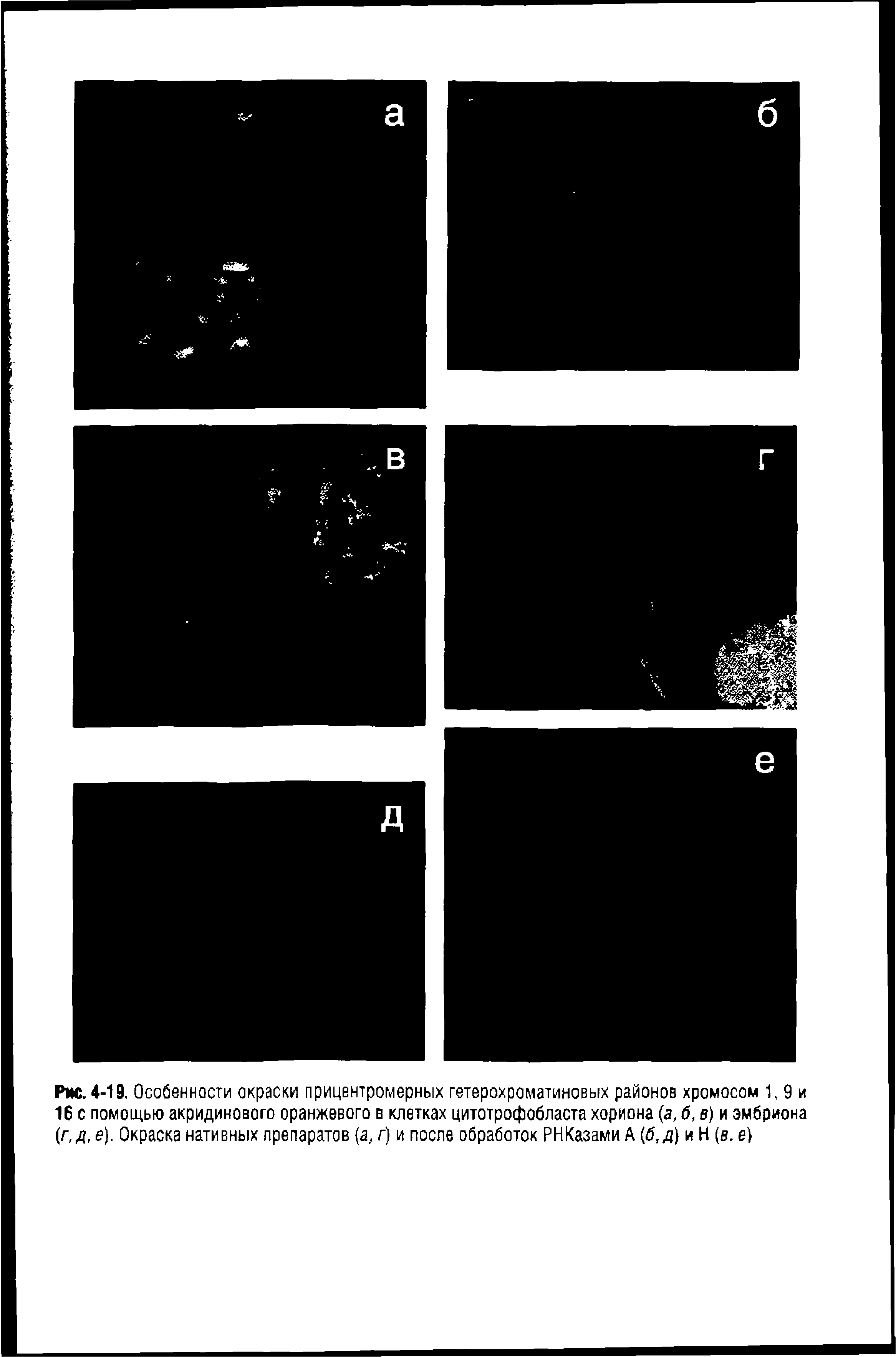 Рис. 4-19. Особенности окраски прицентромерных гетерохроматиновых районов хромосом 1,9 и 16 с помощью акридинового оранжевого в клетках цитотрофобласта хориона (а, б, в) и эмбриона (г,д, е). Окраска нативных препаратов (а, г) и после обработок РНКазами А и Н (в. е)...