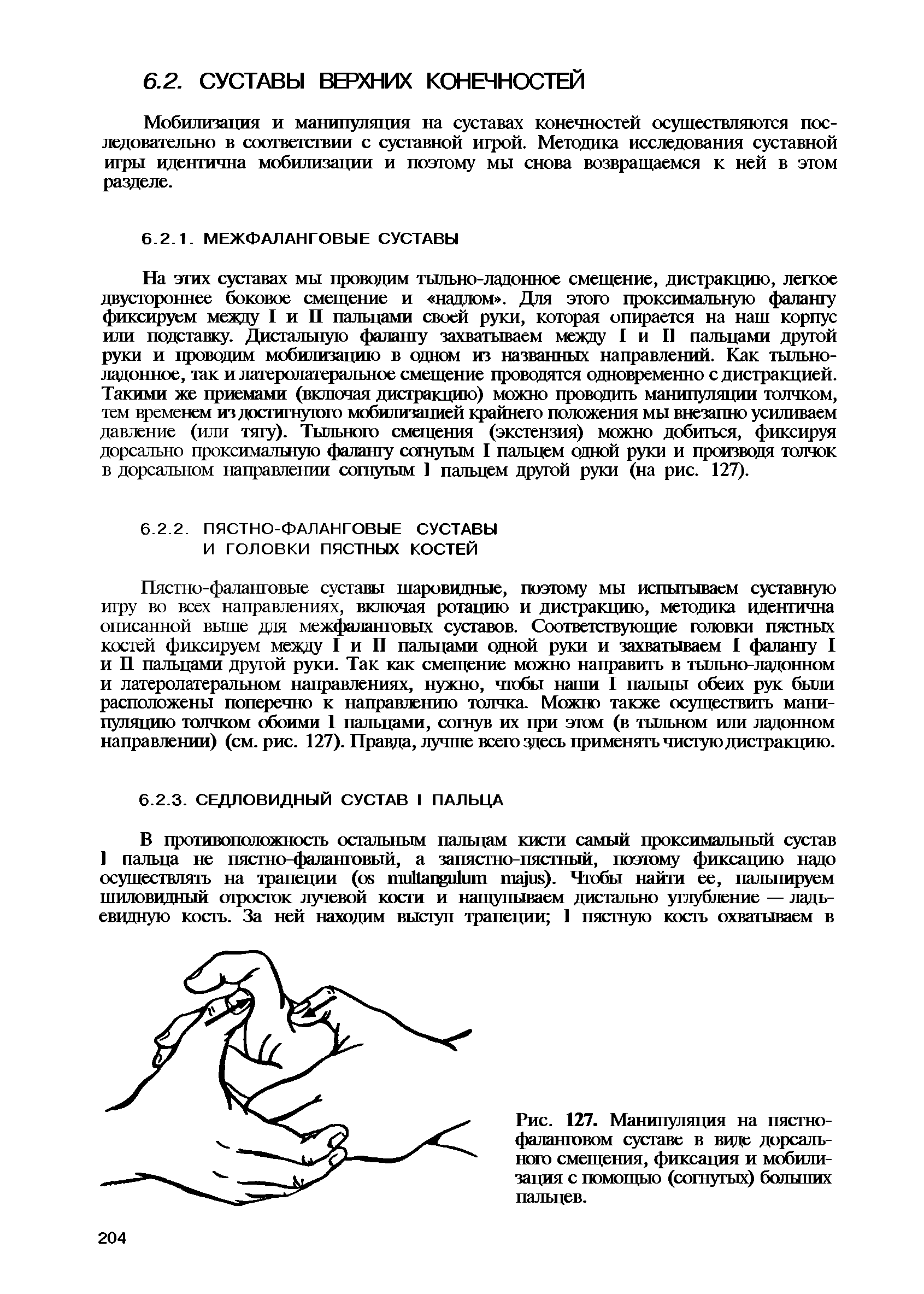 Рис. 127. Манипуляция на пястно-фаланговом суставе в виде дорсального смещения, фиксация и мобилизация с помощью (согнутых) больших пальцев.